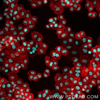 Live SKBR-3 cells immunostained with anti-HER2 (trastuzumab biosimilar) labeled with FlexAble Biotin Antibody Labeling Kit for Human IgG (KFA111) and Streptavidin-ATTO594 (red).  Nuclei are in blue.  Epifluorescence images were acquired with a 20x objective and post-processed.