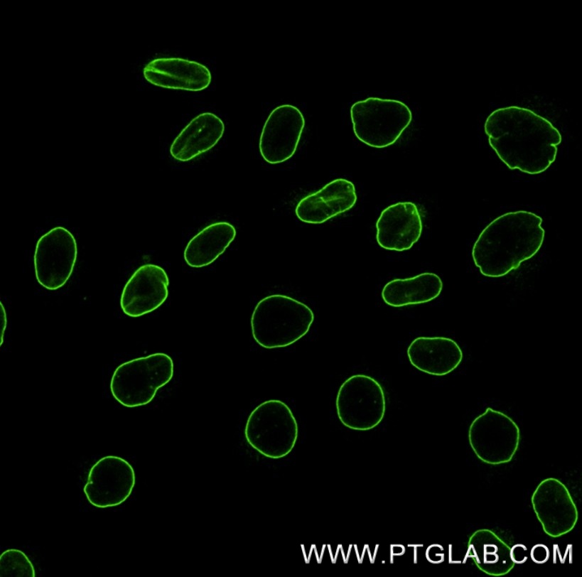 Immunostaining of HeLa cells with rabbit anti-Lamin antibody (12987-1-AP, 1:200, green), which was labeled with a 15-nt DNA oligonucleotide using the KFA151 Kit. Detection was performed by hybridization with an imaging DNA strand carrying ATTO488.