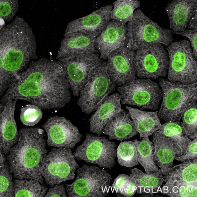 Immunostaining of HeLa cells with mouse IgG2b anti-Tubulin antibodies (66031-1-Ig, 1:100, grey), which was labeled with a 15-nt DNA oligonucleotide using the KFA157 Kit. Detection was performed by hybridization with imaging DNA strands carrying ATTO643. Nuclei are in green.
