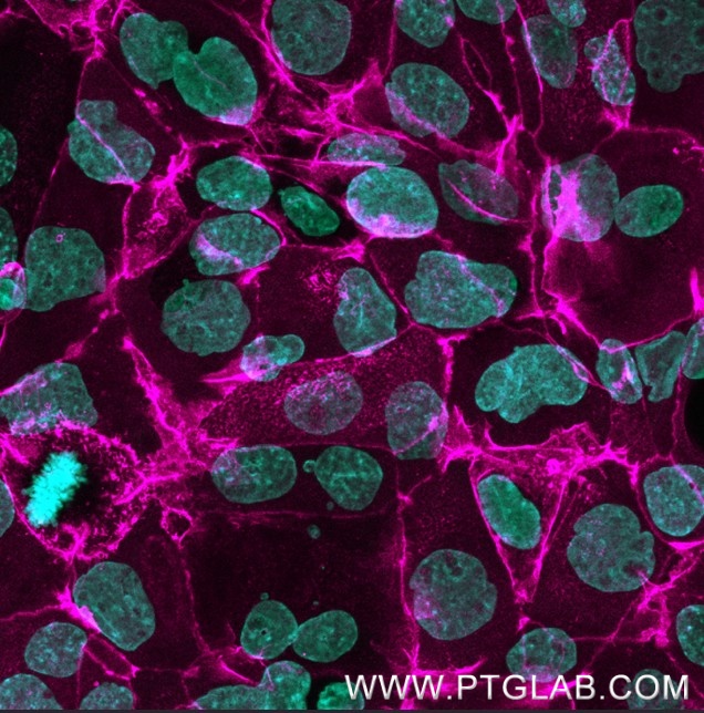 Immunostaining of A431 cells with human anti-EGFR antibodies (cetuximab biosimilar, 1:800, magenta), which was labeled with a 15-nt DNA oligonucleotide using the KFA158 Kit. Detection was performed by hybridization with imaging DNA strands, carrying ATTO643. Nuclei are stained with DAPI (cyan).