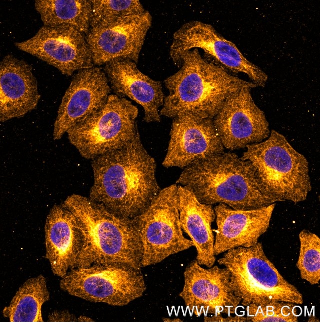 Immunostaining of HeLa cells with rat kappa LC anti-Tubulin antibodies (other vendor, 1:1000, orange), which was labeled with a 15-nt DNA oligonucleotide using the KFA160 Kit. Detection was performed by hybridization with imaging DNA strands carrying ATTO643. Nuclei are in blue.