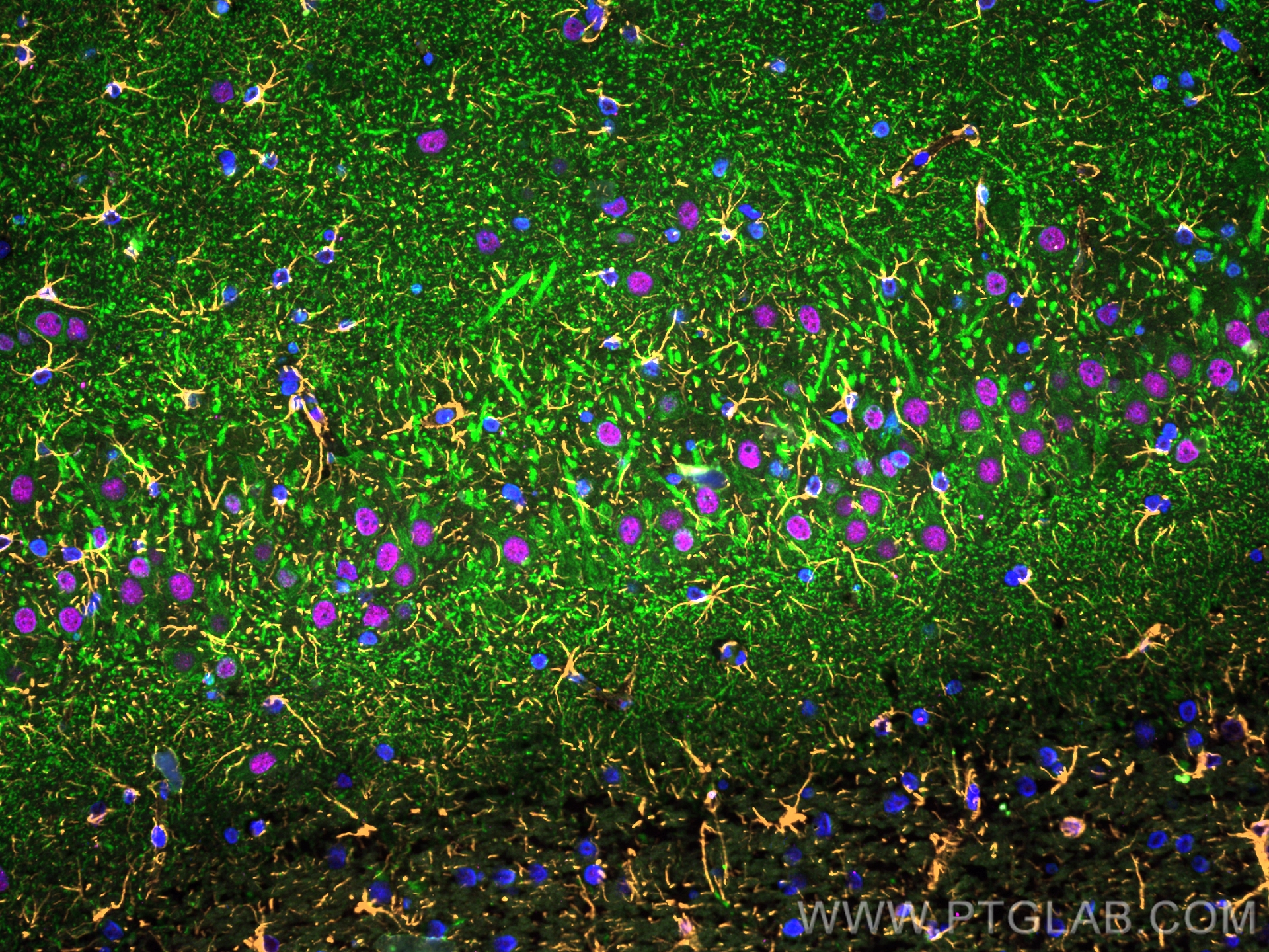 Immunofluorescence of Rat brain: FFPE Rat brain sections were stained with anti-MAP2 (17490-1-AP) labeled with FlexAble 2.0 CoraLite® Plus 488 Kit (KFA501, green), anti-GFAP (60190-1-Ig) labeled with FlexAble 2.0 CoraLite® Plus 555 Kit (KFA542, orange), anti-TDP-43 (67345-1-Ig) labeled with FlexAble 2.0 CoraLite® Plus 647 Kit (KFA543,magenta) and DAPI (blue).