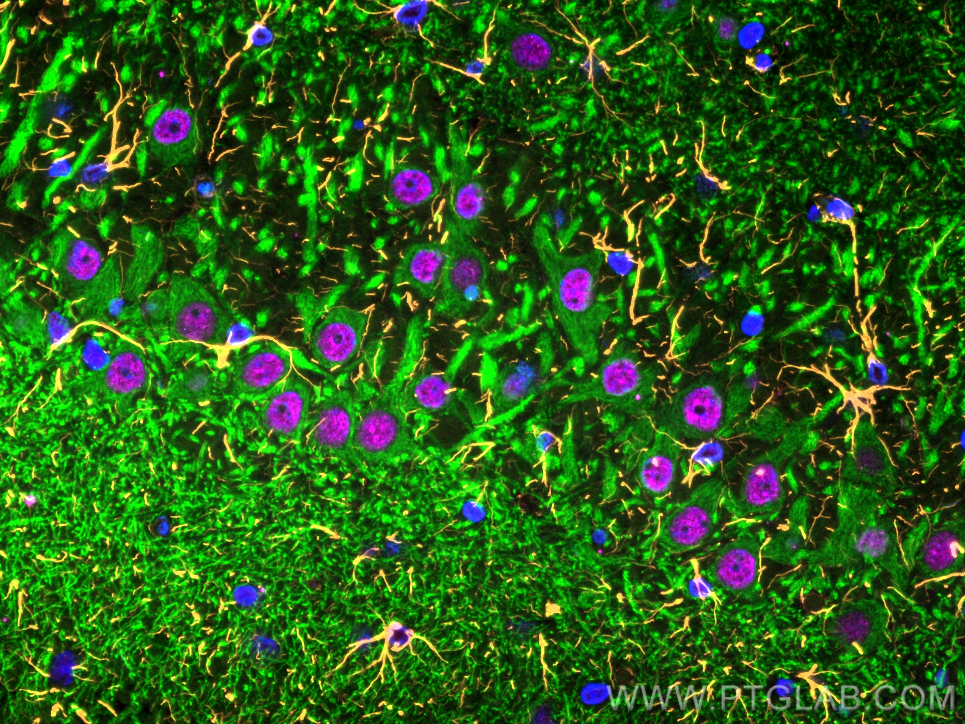 Immunofluorescence of Rat brain: FFPE Rat brain sections were stained with anti-MAP2 (17490-1-AP) labeled with FlexAble 2.0 CoraLite® Plus 488 Kit (KFA501, green), anti-GFAP (60190-1-Ig) labeled with FlexAble 2.0 CoraLite® Plus 555 Kit (KFA542, orange), anti-TDP-43 (67345-1-Ig) labeled with FlexAble 2.0 CoraLite® Plus 647 Kit (KFA543,magenta) and DAPI (blue).