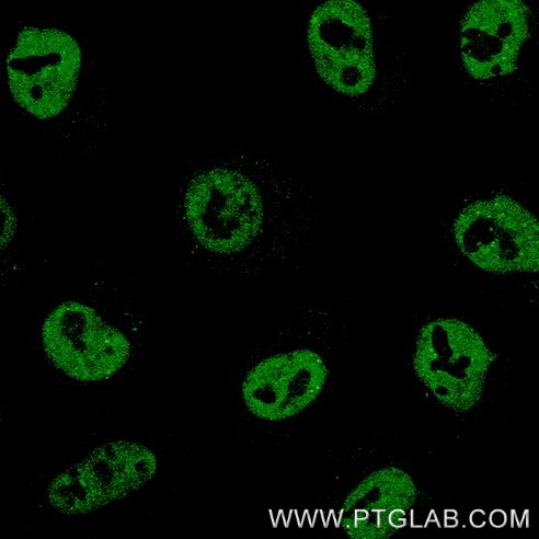 Immunofluorescence of Hela cells: PFA-fixed cells were stained with rabbit IgG anti-TDP43 antibody (10782-2-AP) labeled with FlexAble 2.0 CoraLite® Plus 488 Kit (KFA501, green).

Confocal images were acquired with a 63x oil objective and post-processed. Images were recorded at the Core Facility Bioimaging at the Biomedical Center, LMU Munich.