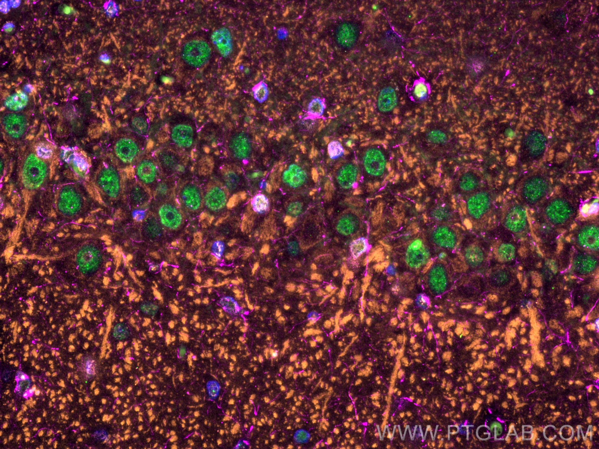 Immunofluorescence of Rat brain: FFPE Rat brain sections were stained with anti-MAP2 (17490-1-AP) labeled with FlexAble 2.0 CoraLite® Plus 555 Kit (KFA502, orange), anti-GFAP (60190-1-Ig) labeled with FlexAble 2.0 CoraLite® Plus 647 Kit (KFA543, magenta), anti-TDP-43 (67345-1-Ig) labeled with FlexAble 2.0 CoraLite® Plus 488 Kit (KFA541,green) and DAPI (blue).
