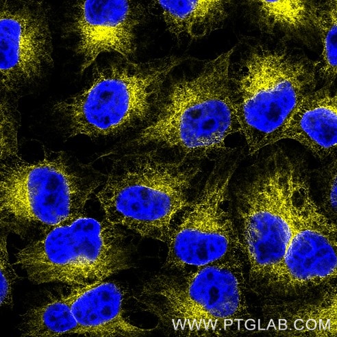 Immunofluorescence of Hela cells: PFA-fixed cells were stained with mouse IgG2a anti-Tubulin antibody (66240-1-Ig) labeled with FlexAble 2.0 CoraLite® Plus 555 Kit (KFA542, green). Cell nuclei were stained with DAPI (blue). 

Confocal images were acquired with a 63x oil objective and post-processed. Images were recorded at the Core Facility Bioimaging at the Biomedical Center, LMU Munich.