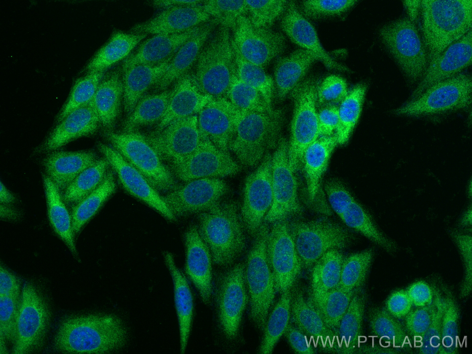 Immunofluorescent analysis of (-20°C Ethanol) fixed HepG2 cells using KEAP1 antibody (80744-1-RR, Clone: 5O18 ) at dilution of 1:1000 and CoraLite®488-Conjugated AffiniPure Goat Anti-Rabbit IgG(H+L).