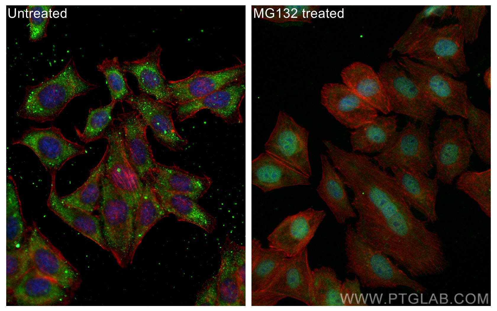 Immunofluorescent analysis of (-20°C Ethanol) fixed MG132 treated HepG2 cells using NRF2, NFE2L2 antibody (80593-1-RR, Clone: 1I21 ) at dilution of 1:600 and CoraLite®488-Conjugated AffiniPure Goat Anti-Rabbit IgG(H+L), CL594-Phalloidin (red).