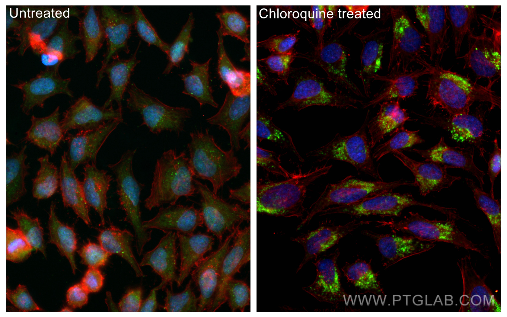 Immunofluorescent analysis of (-20°C Methanol) fixed Chloroquine treated HeLa cells using LC3 antibody (81004-1-RR, Clone: 5P12 ) at dilution of 1:1000 and CoraLite®488-Conjugated AffiniPure Goat Anti-Rabbit IgG(H+L), CoraLite®594 Beta Actin antibody (CL594-66009, Clone: 2D4H5, red).