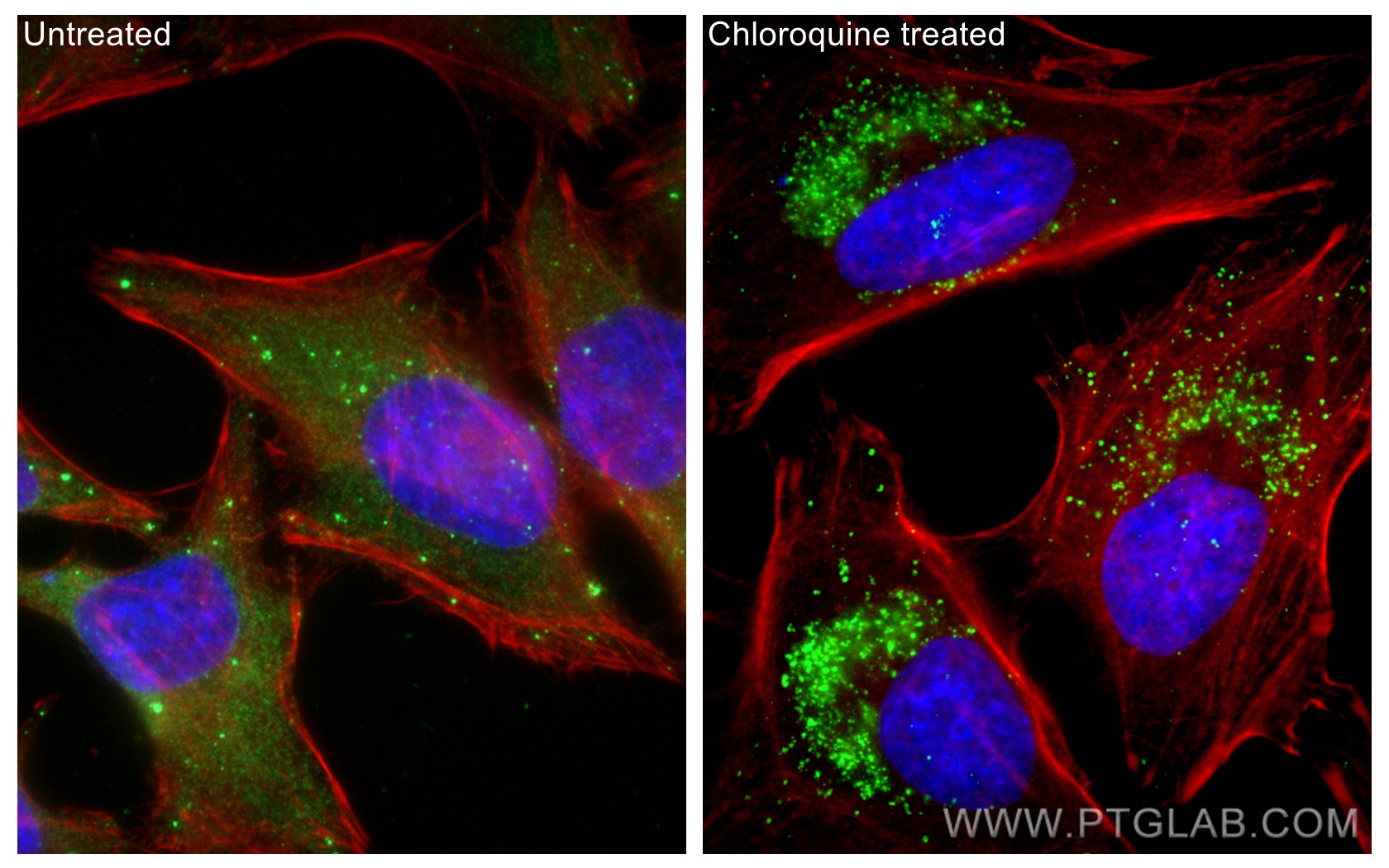 Immunofluorescent analysis of (-20°C Ethanol) fixed Chloroquine treated HeLa cells using P62,SQSTM1 antibody (80294-1-RR, Clone: 1D17 ) at dilution of 1:500 and CoraLite®488-Conjugated Goat Anti-Rabbit IgG(H+L), CL594-Phalloidin (red).