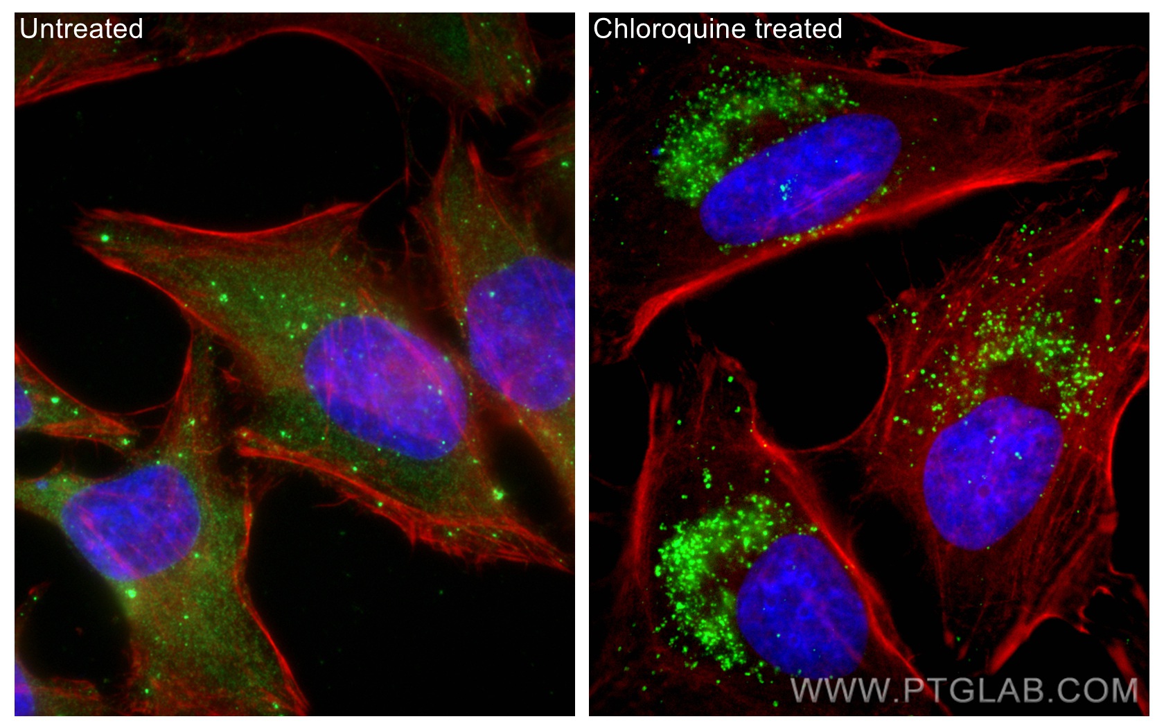 Immunofluorescent analysis of (-20°C Ethanol) fixed Chloroquine treated HeLa cells using P62,SQSTM1 antibody (80294-1-RR, Clone: 1D17 ) at dilution of 1:500 and CoraLite®488-Conjugated AffiniPure Goat Anti-Rabbit IgG(H+L), CL594-Phalloidin (red).