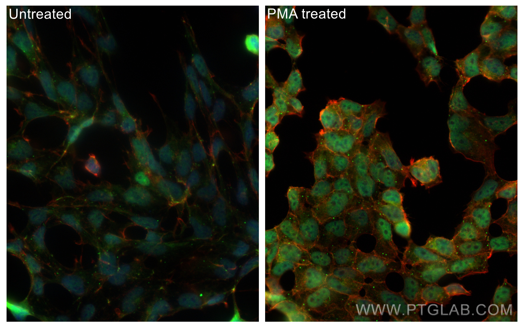 Immunofluorescent analysis of (4% PFA) fixed PMA treated HEK-293 cells using Phospho-mTOR (Ser2448) antibody (80596-1-RR, Clone: 3L18 ) at dilution of 1:1000 and CoraLite®488-Conjugated Goat Anti-Rabbit IgG(H+L), CL594-phalloidin (red).