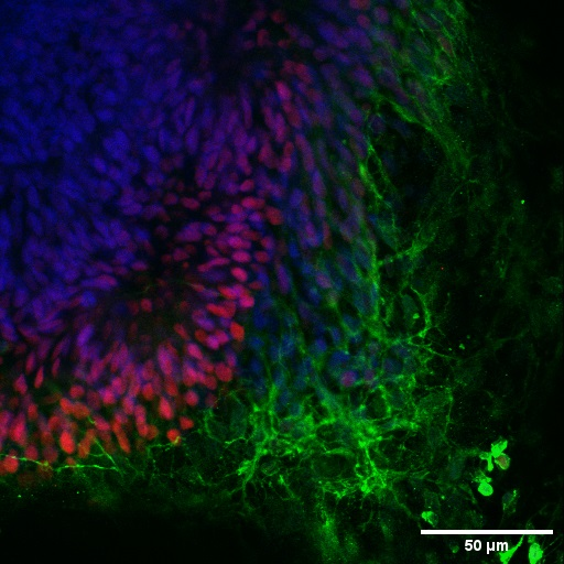Retinal organoids (day 30) generated from human induced pluripotent stem cells (iPSCs) and fixed with 4% PFA. Stained for Tubulin beta 3/TUJ1 using 66375-1-Ig at 1:500 dilution (green) and PAX6 (12323-1-AP) at 1:500. Nuclear stain DAPI (blue). Scale bar = 50 µm. Data generated by Alessandro Bellapianta at Johannes Kepler Universitat, Austria. 