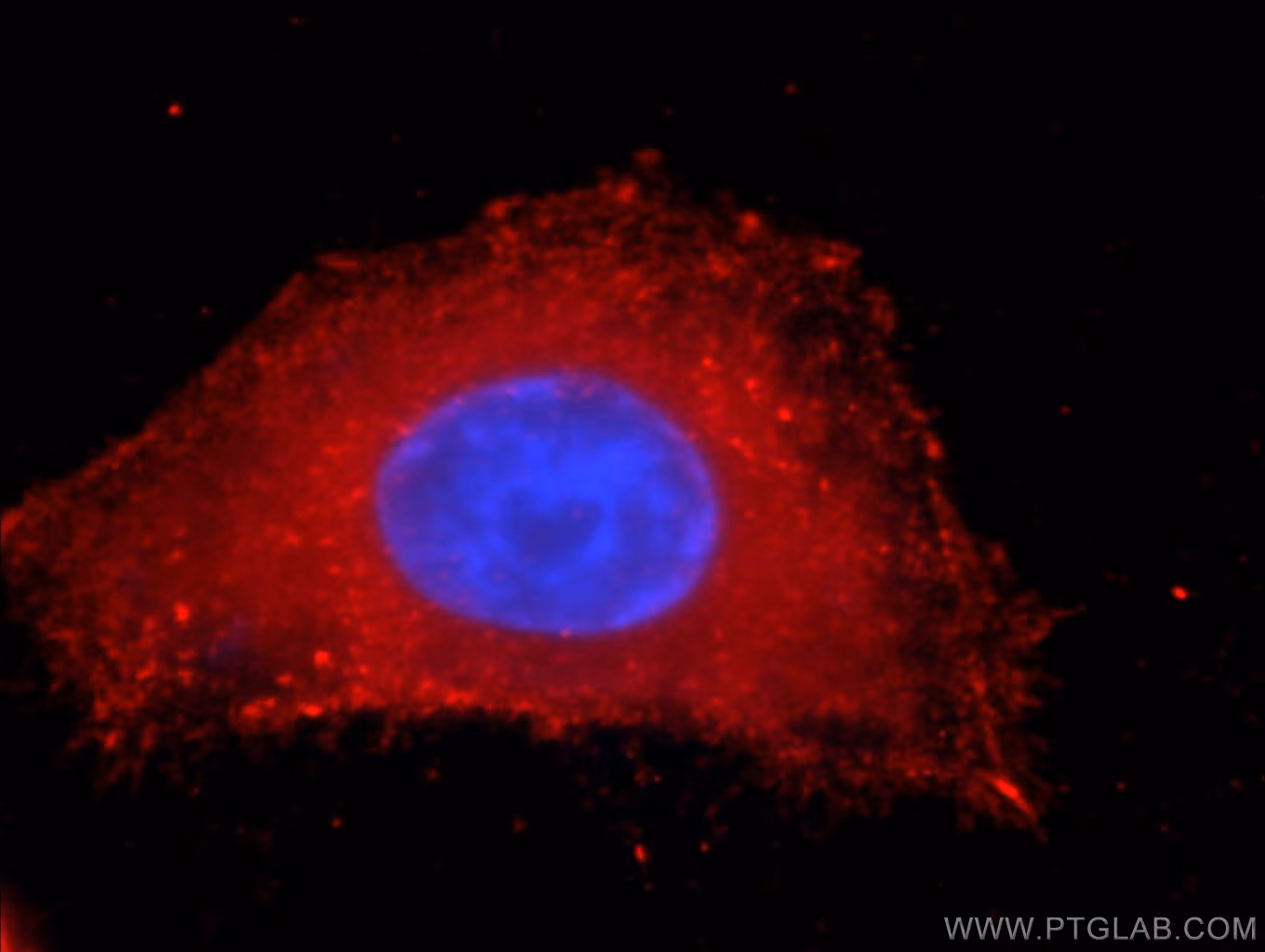 Immunofluorescent analysis of HepG2 cells using 66119-1-Ig (PDH E1α antibody) at dilution of 1:100 and Rhodamine-Goat anti-Mouse IgG.