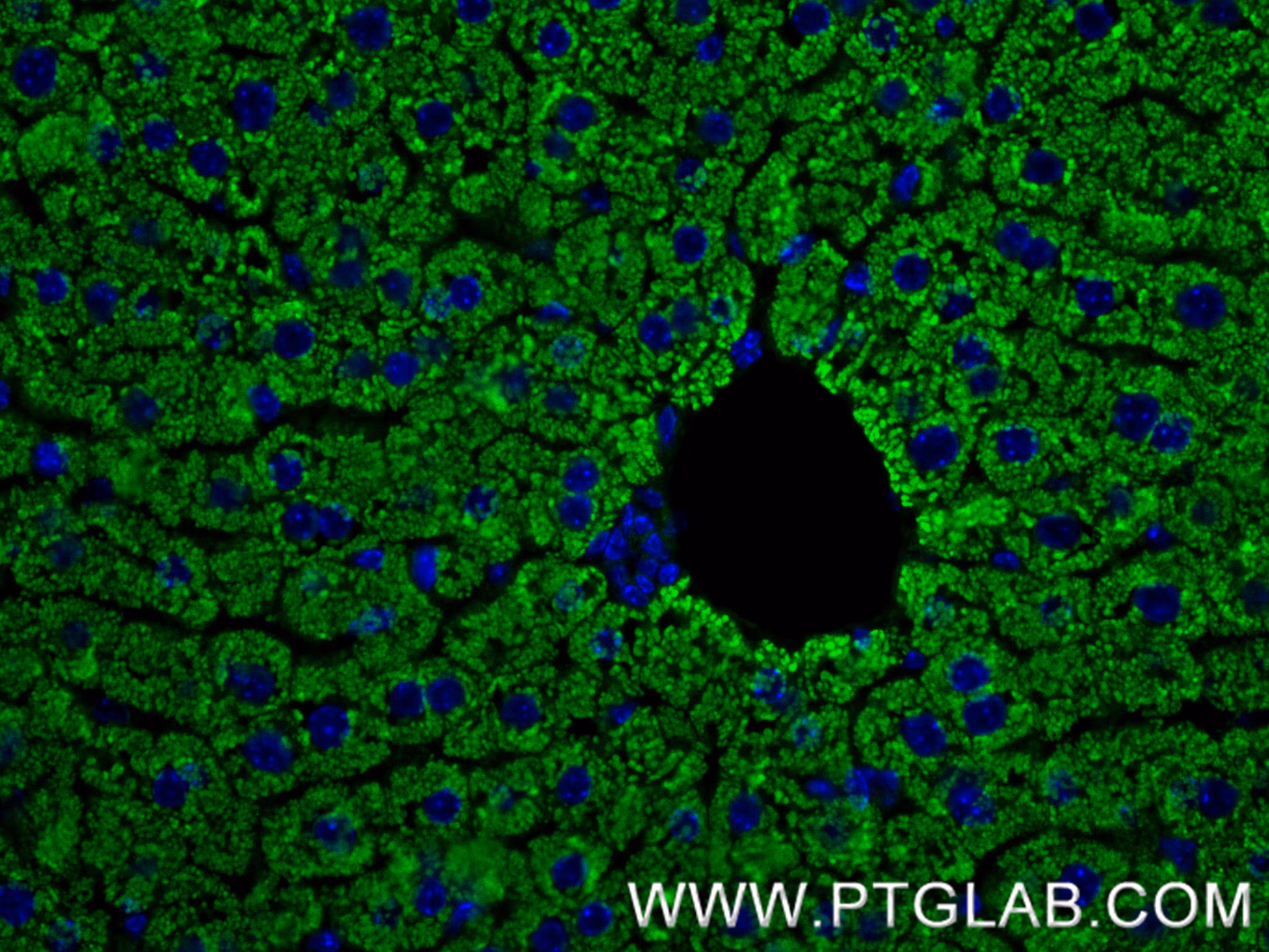 Immunofluorescent analysis of (4% PFA) fixed paraffin-embedded mouse liver tissue using ATP7B-Specific antibody (85288-2-RR, Clone: 242827B3 ) at dilution of 1:400 and CoraLite®488-Conjugated Goat Anti-Rabbit IgG(H+L) (SA00013-2). Heat mediated antigen retrieval with Tris-EDTA buffer (pH 9.0).
