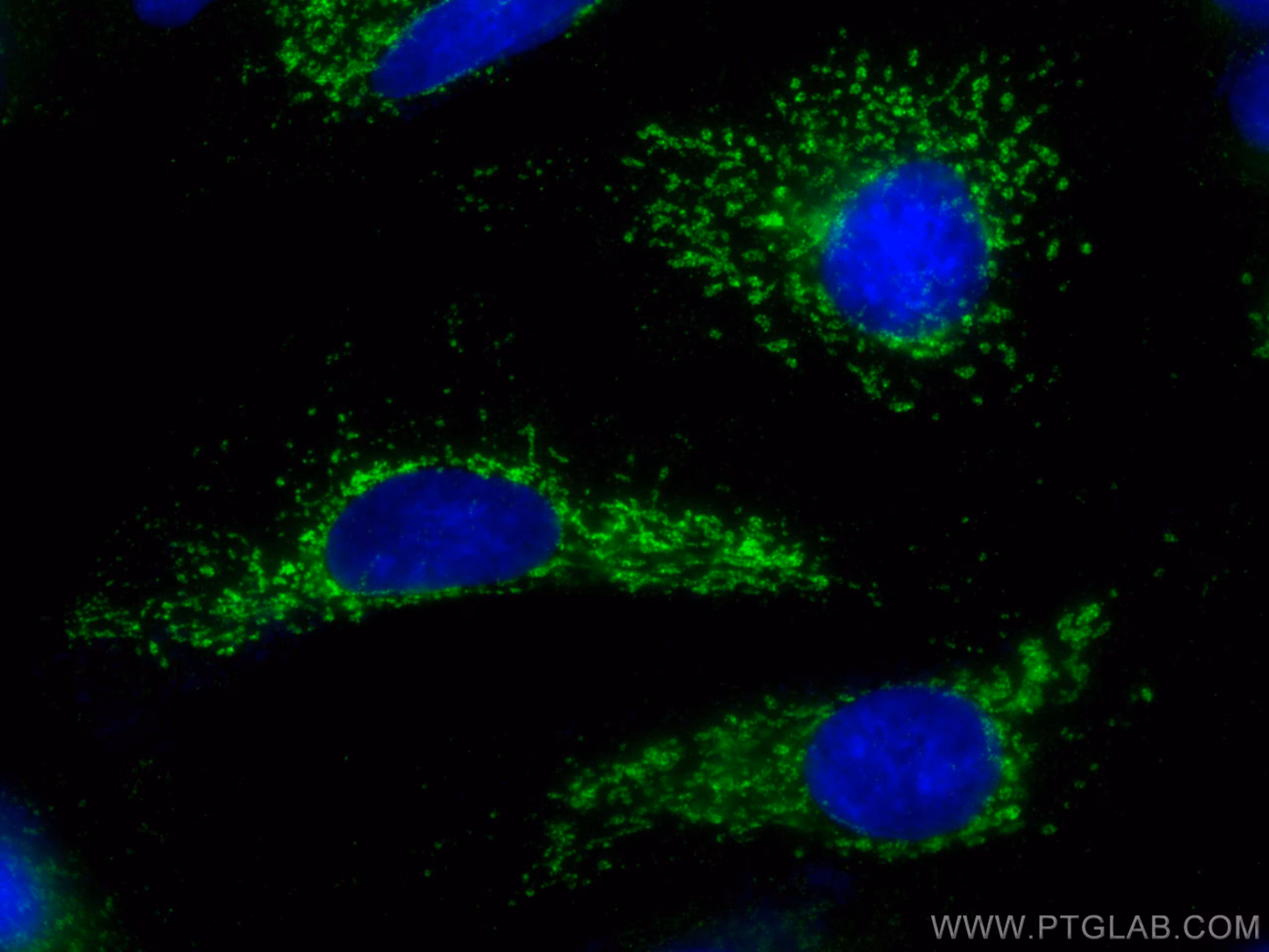 Immunofluorescent analysis of (-20°C Methanol) fixed A549 cells using GLS antibody (81486-1-RR, Clone: 4C20 ) at dilution of 1:1000 and CoraLite®488-Conjugated AffiniPure Goat Anti-Rabbit IgG(H+L) (SA00013-2).