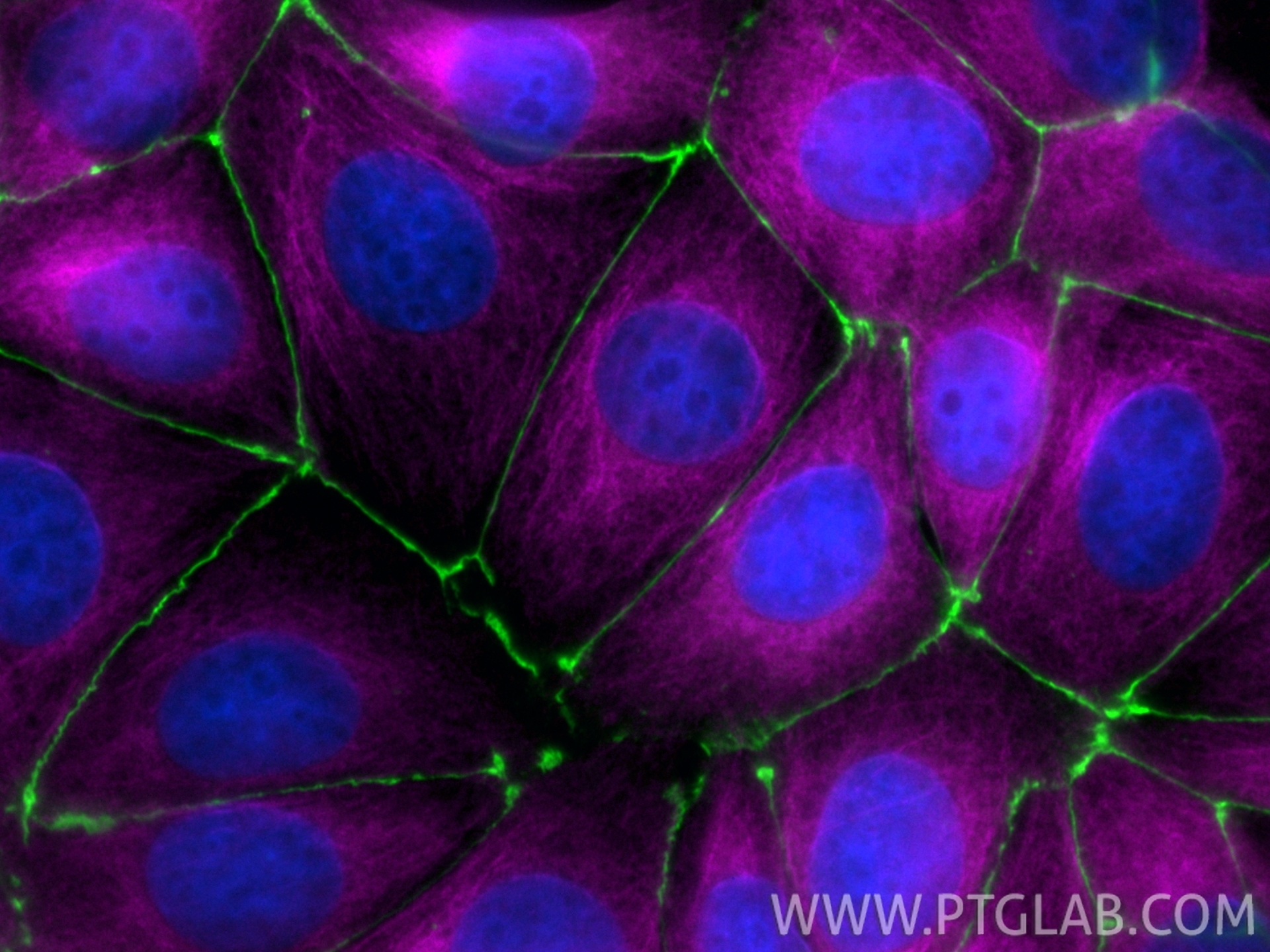 MCF-7 细胞免疫荧光实验：
经多聚甲醛（PFA）固定的细胞分别使用以下抗体染色：抗 ZO-1 抗体（货号：21773-1-AP），经 Chembright 标记试剂盒（货号：PK30030）标记，显绿色荧光；抗 Tubulin-Alpha抗体（货号：66031-1-Ig），经 Chembright 标记试剂盒（货号：PK30031）标记，显品红色荧光；细胞核使用 DAPI 染色，显蓝色荧光。
