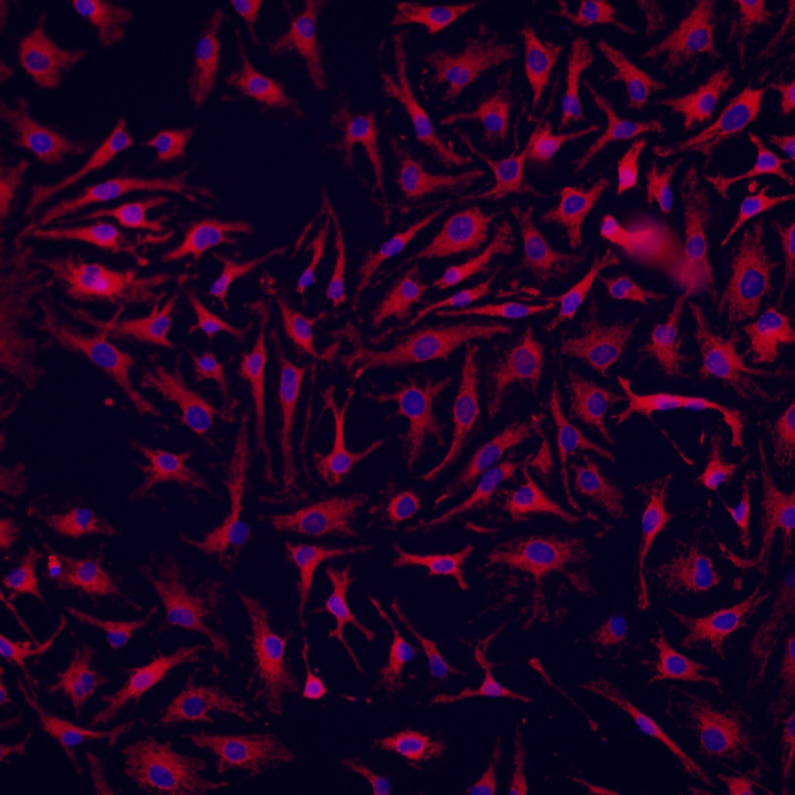 采用4%多聚甲醛（PFA）固定的HeLa细胞进行免疫荧光分析，使用经ChemBright CoraLite® Plus 647抗体标记试剂盒（货号：PK30031）偶联的TOM20多克隆抗体（货号：11802-1-AP）进行染色，抗体稀释比例为1:500。