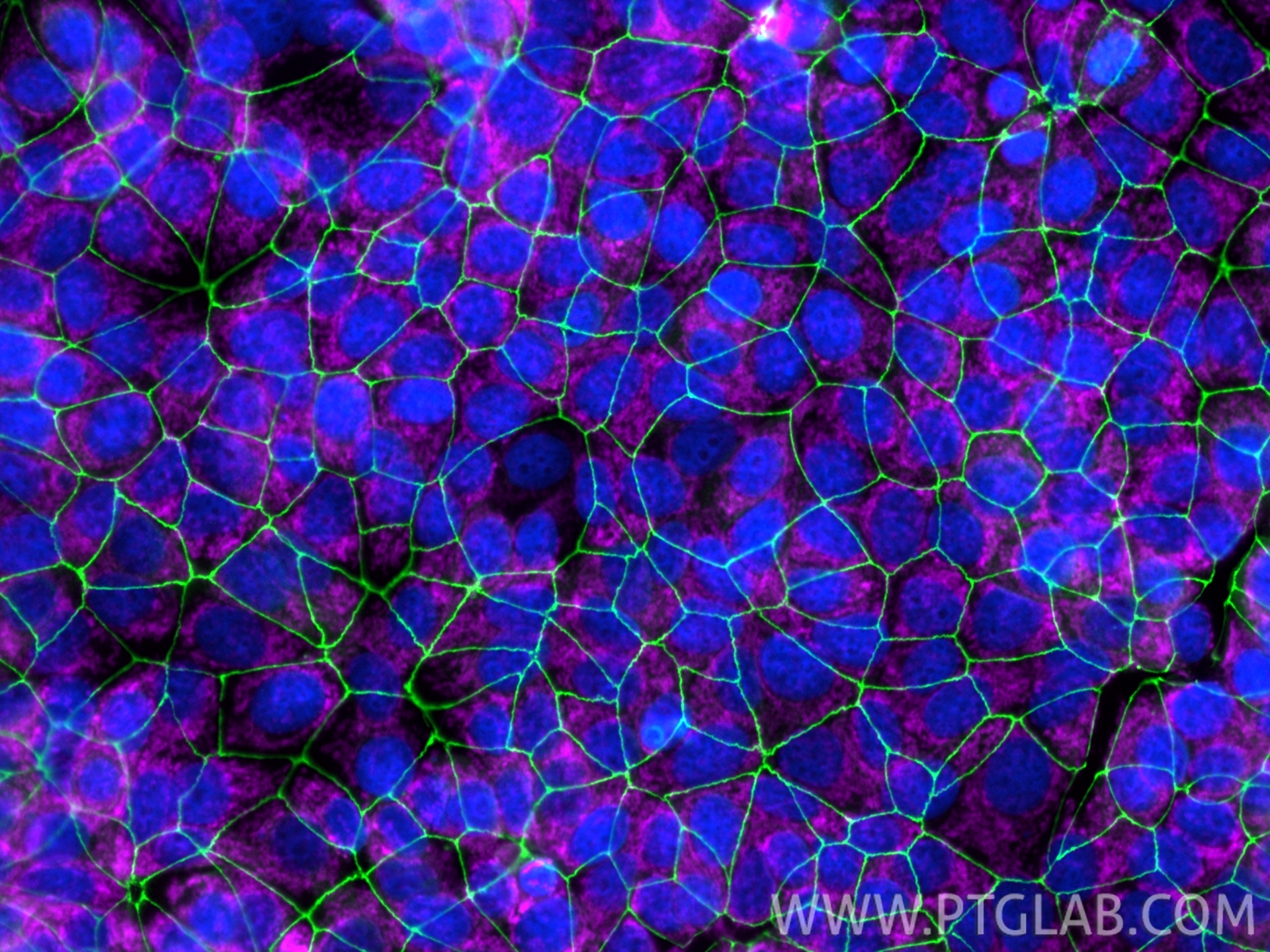 MCF-7 细胞免疫荧光实验：
经多聚甲醛（PFA）固定的细胞，分别用以下抗体染色：抗 ZO-1 抗体（货号：21773-1-AP），经 Chembright 试剂盒（货号：PK30030）标记，呈绿色荧光；抗 TOM20 抗体（货号：80501-1-RR），经 Chembright 试剂盒（货号：PK30031）标记，呈品红色荧光；细胞核用 DAPI 染色，呈蓝色荧光。