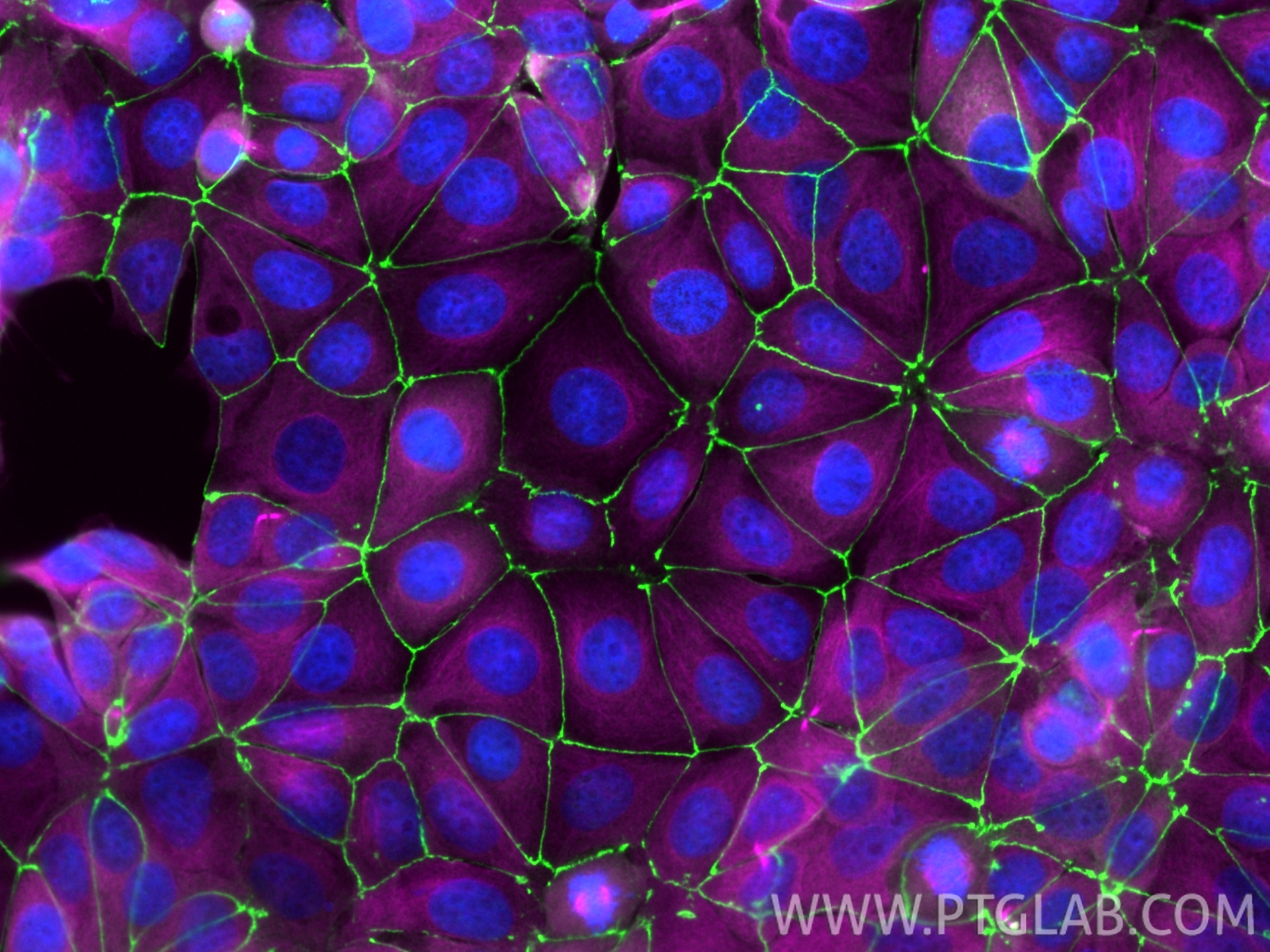 MCF-7 细胞免疫荧光实验：
经多聚甲醛（PFA）固定的细胞分别使用以下抗体染色：抗 ZO-1 抗体（货号：21773-1-AP），经 Chembright 标记试剂盒（货号：PK30030）标记，显绿色荧光；抗 Tubulin-Alpha抗体（货号：66031-1-Ig），经 Chembright 标记试剂盒（货号：PK30031）标记，显品红色荧光；细胞核使用 DAPI 染色，显蓝色荧光。