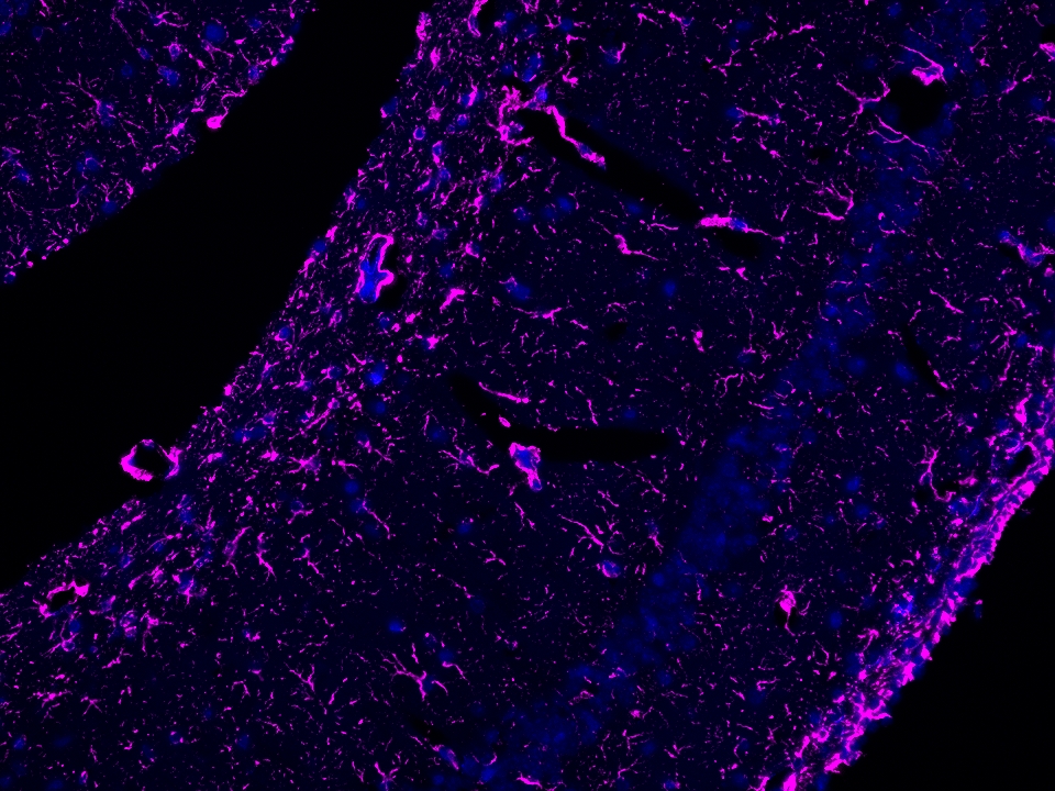 IF Staining using Biotin-TSA Reagent PR30029. FFPE mouse brain tissue was stained with HRP conjugated GFAP monoclonal antibody at 0.5 μg/mL followed by signal amplification using with Biotin-TSA Reagent PR30029 for 10 minutes at room temperature. Streptavidin-CoraLite® Plus 647 Conjugate (Cat.NO. CL647-PF00030) was diluted at 1:500 and reacted for 10 minutes at room temperature for detection.  Cell nucleus (blue) was stained with DAPI.