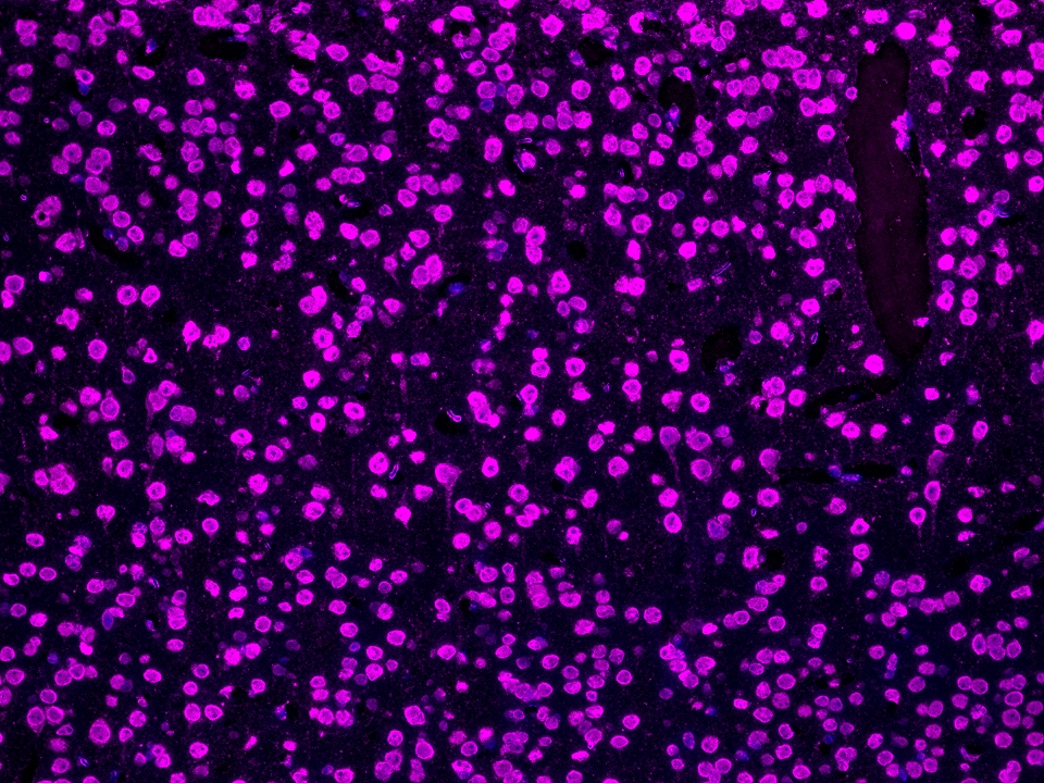 IF Staining using Biotin-TSA Reagent PR30029. FFPE mouse brain tissue was stained with HRP conjugated TDP43 rabbit recombinant antibody at 0.5 μg/mL followed by signal amplification using with Biotin-TSA Reagent PR30029 for 10 minutes at room temperature. Streptavidin-CoraLite® Plus 647 Conjugate (Cat.NO. CL647-PF00030) was diluted at 1:500 and reacted for 10 minutes at room temperature for detection. Cell nucleus (blue) was stained with DAPI.