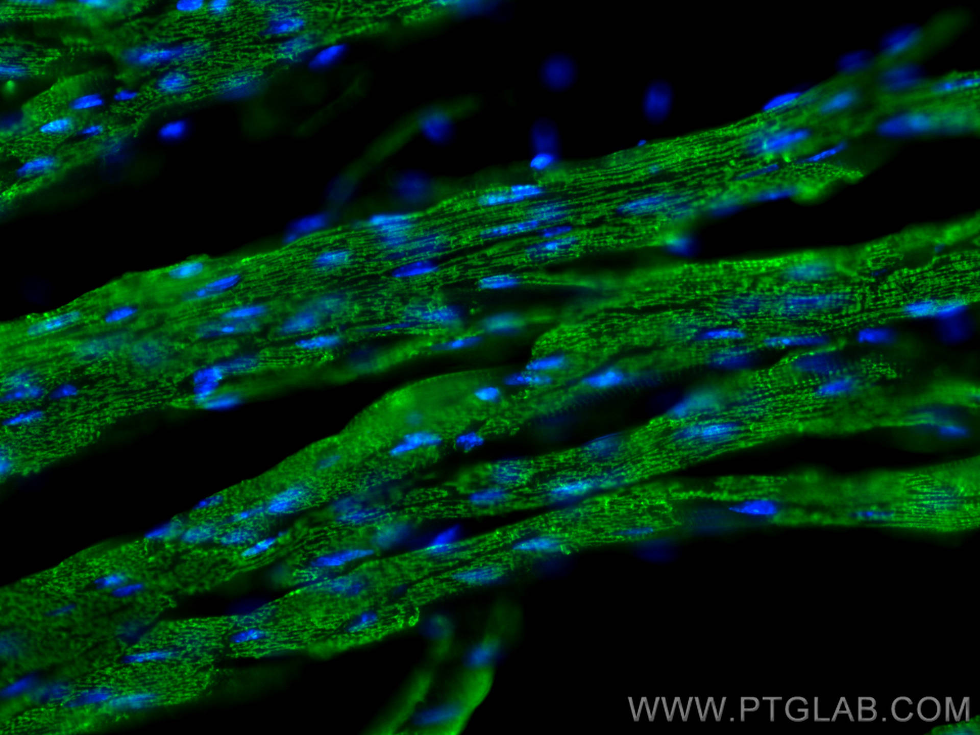 Immunofluorescent analysis of (4% PFA) fixed OCT-embedded frozen mouse heart tissue using ACTC1-specific antibody (66125-1-Ig, Clone: 1F2B9 ) at dilution of 1:800 and Multi-rAb CoraLite ® Plus 488-Goat Anti-Mouse Recombinant Secondary Antibody (H+L) (RGAM002).