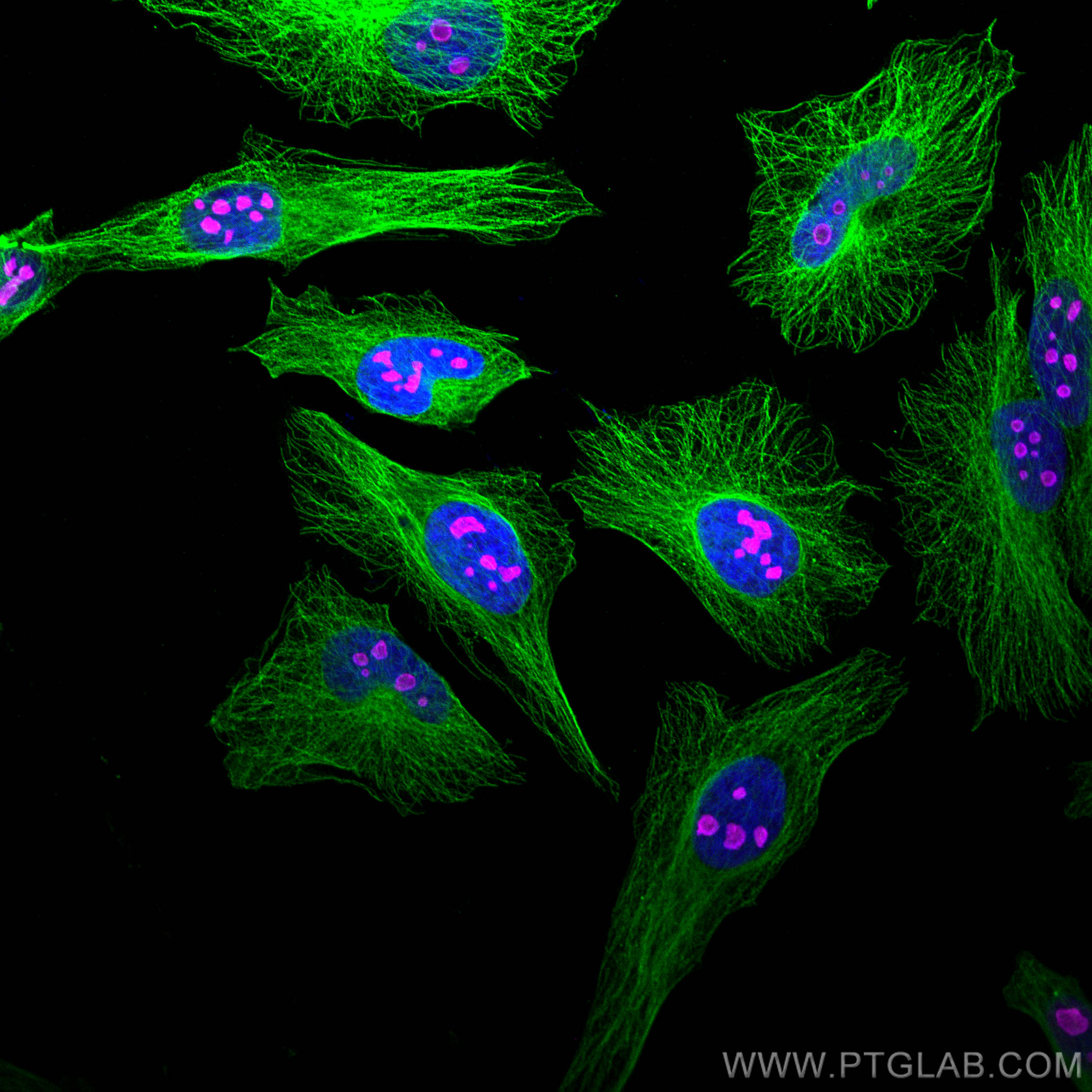 Immunofluorescence of Hela cells: Hela cells were fixed with 4% PFA and stained with Rabbit anti-Alpha Tubulin polyclonal antibody (11224-1-AP, 1:200, green) and mouse anti-NPM1 monoclonal antibody (60096-1-Ig, 1:1000, magenta). Multi-rAb™ CoraLite® Plus 488-Goat Anti-Rabbit Recombinant Secondary Antibody (H+L) (RGAR002, 1:500) and Multi-rAb™ CoraLite® Plus 647-Goat Anti-Mouse Recombinant Secondary Antibody (H+L) (RGAM005, 1:500) were used for detection. 