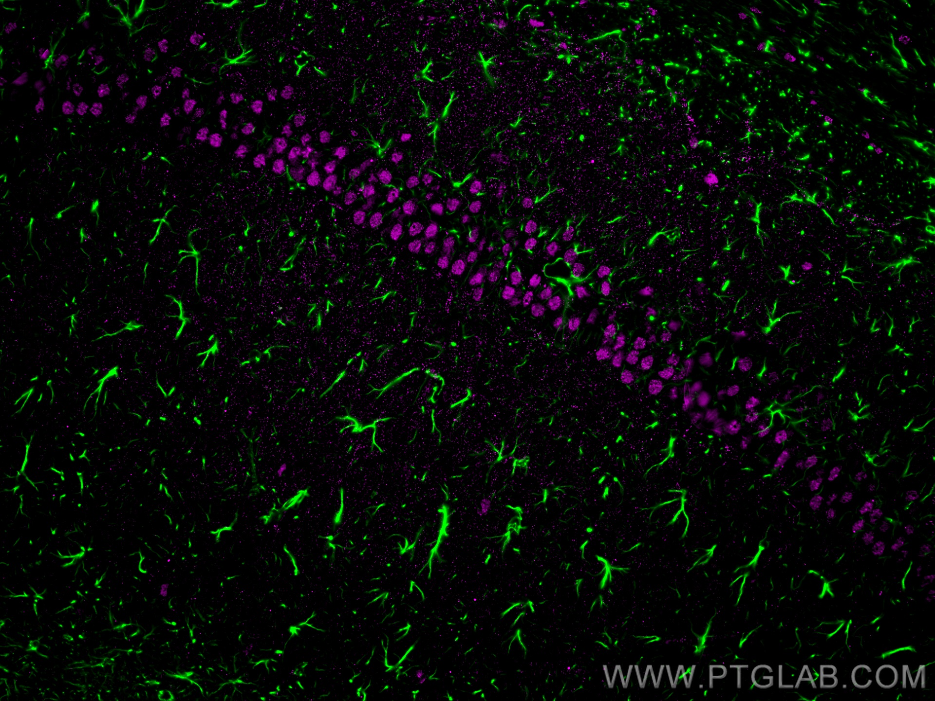 Immunofluorescence of rat brain: rat brain FFPE section was stained with Rabbit anti-GFAP polyclonal antibody (16825-1-AP, 1:200, green) and mouse anti-NeuN monoclonal antibody (66836-1-Ig, magenta). Multi-rAb CoraLite® Plus 488 conjugated Recombinant Goat anti-rabbit secondary antibody (RGAR002, 1:500) and Multi-rAb CoraLite® Plus 647 conjugated Goat Anti-Mouse Recombinant Secondary Antibody (H+L) were used for detection (RGAM005, 1:500) . 