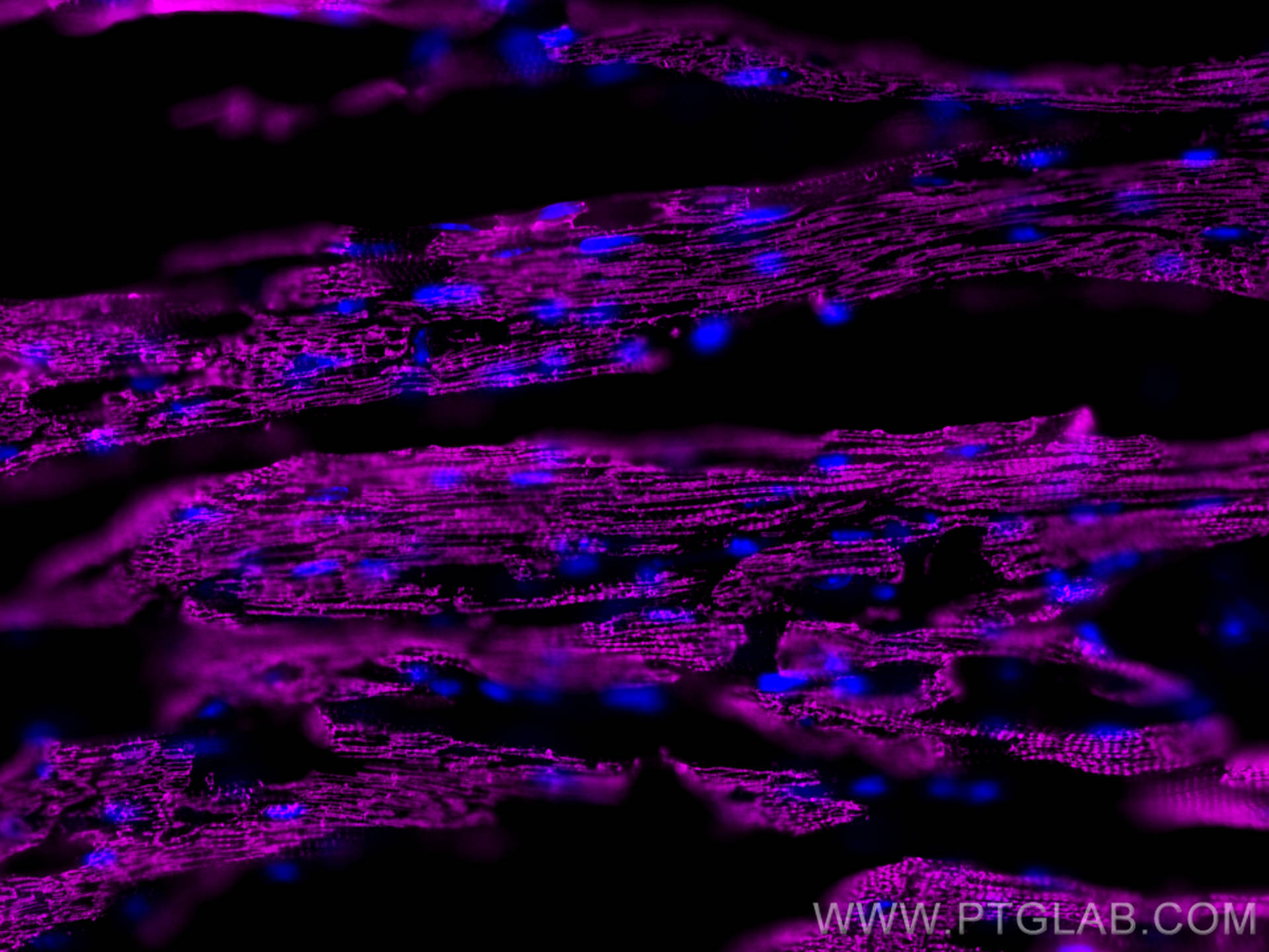 Immunofluorescent analysis of (4% PFA) fixed OCT-embedded frozen mouse heart tissue using ACTC1-specific antibody (66125-1-Ig, Clone: 1F2B9 ) at dilution of 1:800 and Multi-rAb CoraLite ® Plus 647-Goat Anti-Mouse Recombinant Secondary Antibody (H+L) (RGAM005).