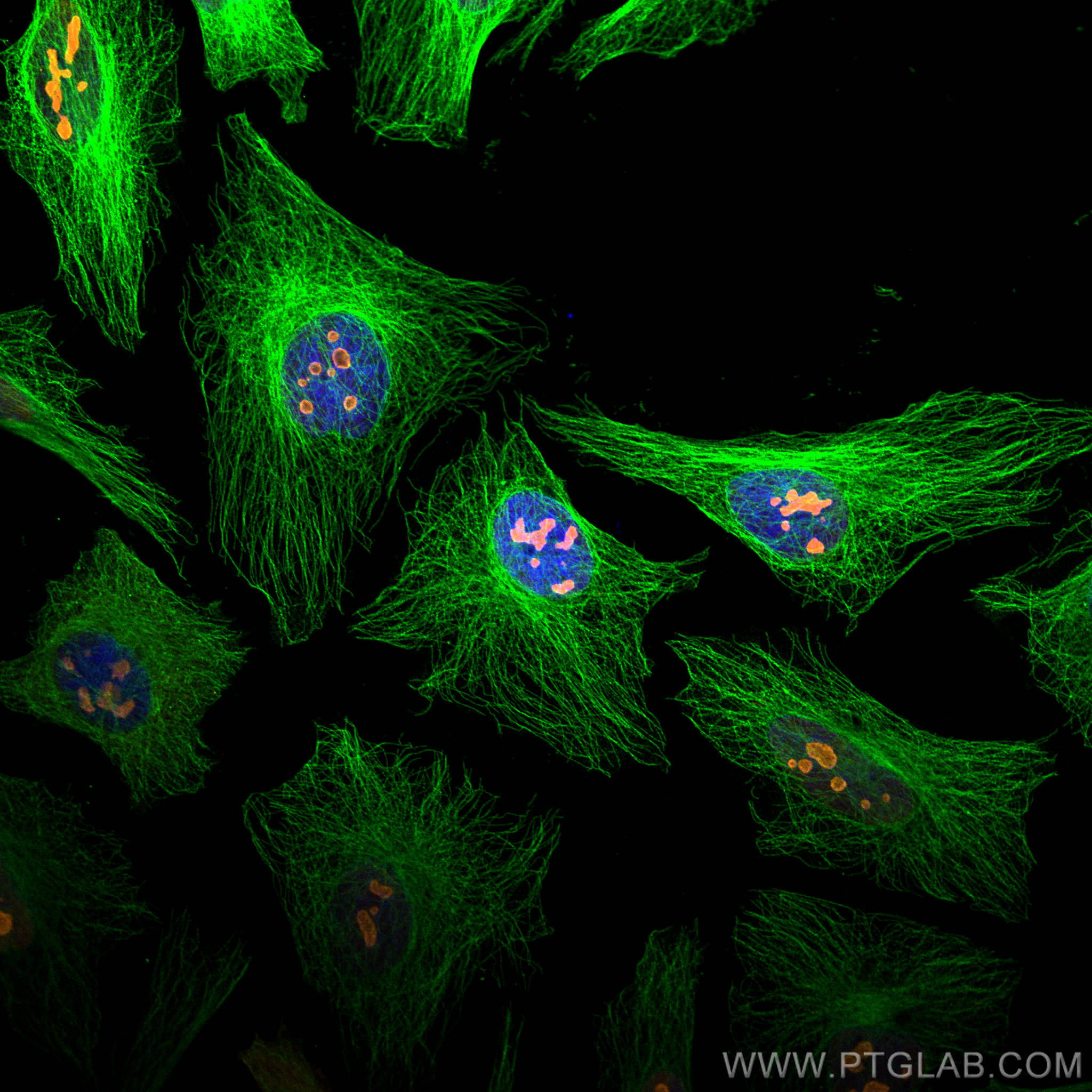 Immunofluorescence of Hela cells: Hela cells were fixed with 4% PFA and stained with Rabbit anti-Alpha Tubulin polyclonal antibody (11224-1-AP, 1:200, green) and mouse anti-NPM1 monoclonal antibody (60096-1-Ig, 1:1000, orange). Multi-rAb CoraLite® Plus 488-Goat Anti-Rabbit Recombinant Secondary Antibody (H+L) (RGAR002, 1:500) and Multi-rAb CoraLite® Plus 555-Goat Anti-Mouse Recombinant Secondary Antibody (H+L) (RGAM003, 1:500) were used for detection.