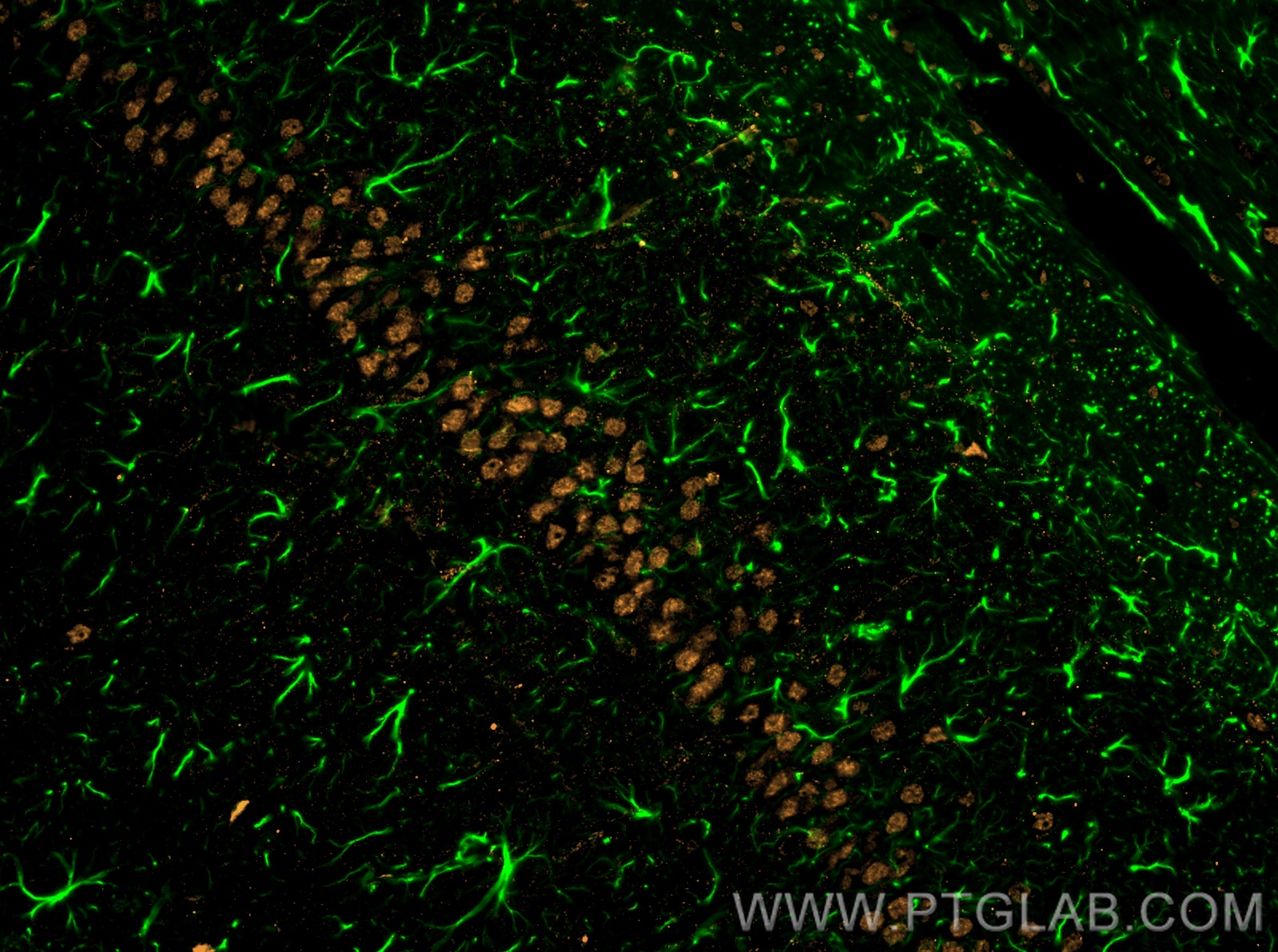 Immunofluorescence of rat brain: rat brain FFPE section was stained with Rabbit anti-GFAP polyclonal antibody (16825-1-AP, 1:200, green) and mouse anti-NeuN monoclonal antibody (66836-1-Ig, orange). Multi-rAb CoraLite® Plus 488 conjugated Recombinant Goat anti-rabbit secondary antibody (RGAR002, 1:500) and Multi-rAb CoraLite® Plus 555 conjugated Goat Anti-Mouse Recombinant Secondary Antibody (H+L) were used for detection (RGAM003, 1:500) .