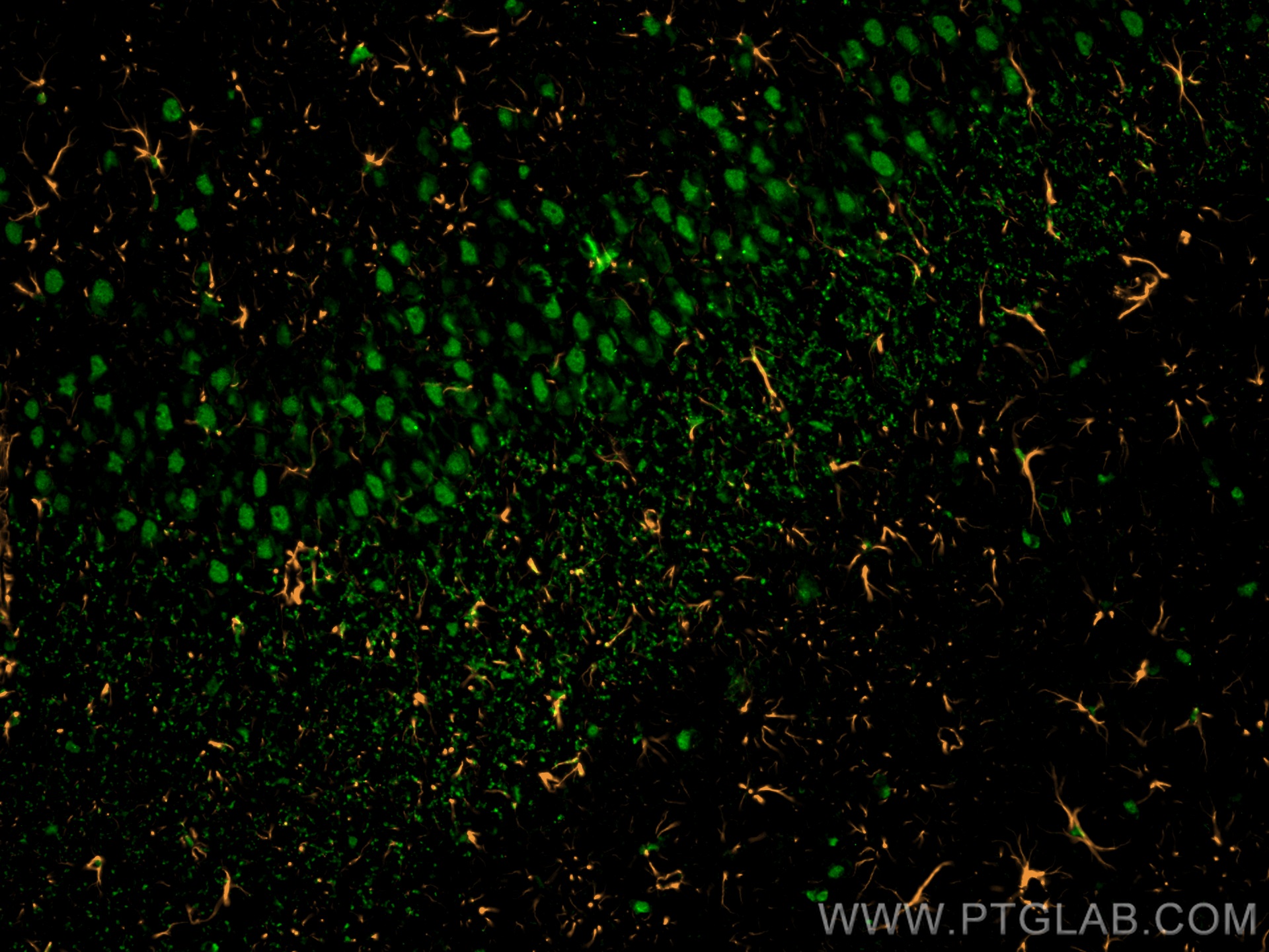 Immunofluorescence of rat brain: rat brain FFPE section was stained with Rabbit anti-GFAP polyclonal antibody (16825-1-AP, 1:200, orange) and mouse anti-NeuN monoclonal antibody (66836-1-Ig, green). Multi-rAb™ CoraLite® Plus 555 conjugated Recombinant Goat anti-rabbit secondary antibody (RGAR003, 1:500) and Multi-rAb™ CoraLite® Plus 488 conjugated Goat Anti-Mouse Recombinant Secondary Antibody (H+L) were used for detection (RGAM002, 1:500) . 