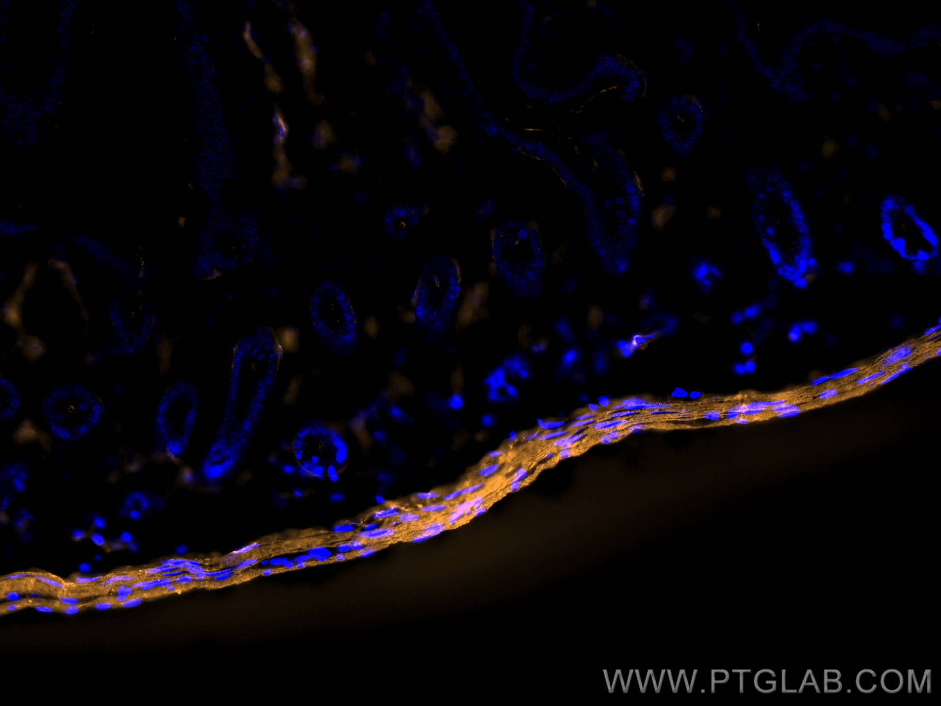 Immunofluorescent analysis of (4% PFA) fixed OCT-embedded frozen mouse small intestine tissue using smooth muscle actin antibody (14395-1-AP) at dilution of 1:400 and Multi-rAb CoraLite ® Plus 555-Goat Anti-Rabbit Recombinant Secondary Antibody (H+L) (RGAR003).