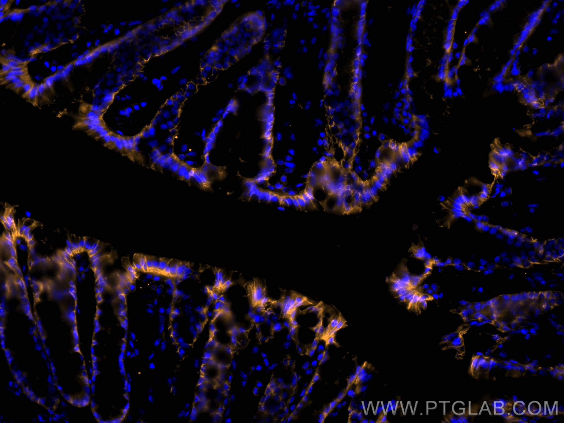 Immunofluorescent analysis of (4% PFA) fixed OCT-embedded frozen mouse colon tissue using E-cadherin antibody (20874-1-AP) at dilution of 1:400 and Multi-rAb CoraLite ® Plus 555-Goat Anti-Rabbit Recombinant Secondary Antibody (H+L) (RGAR003).