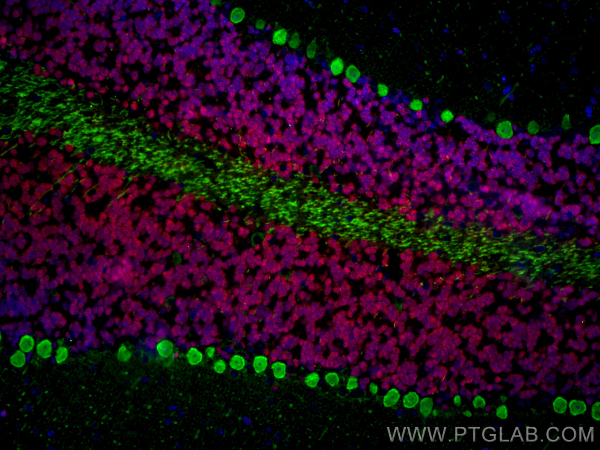 Immunofluorescence of mouse cerebellum: mouse cerebellum FFPE section was stained with Rabbit anti-NeuN polyclonal antibody (26975-1-AP, 1:200, red) and mouse anti-Calbindin-D28k monoclonal antibody (66394-1-Ig, 1:200, green). Multi-rAb™ CoraLite® Plus 594 conjugated Recombinant Goat anti-rabbit secondary antibody (RGAR004, 1:500) and Multi-rAb™ CoraLite® Plus 488 conjugated Goat Anti-Mouse Recombinant Secondary Antibody (H+L) were used for detection (RGAM002, 1:500) . 