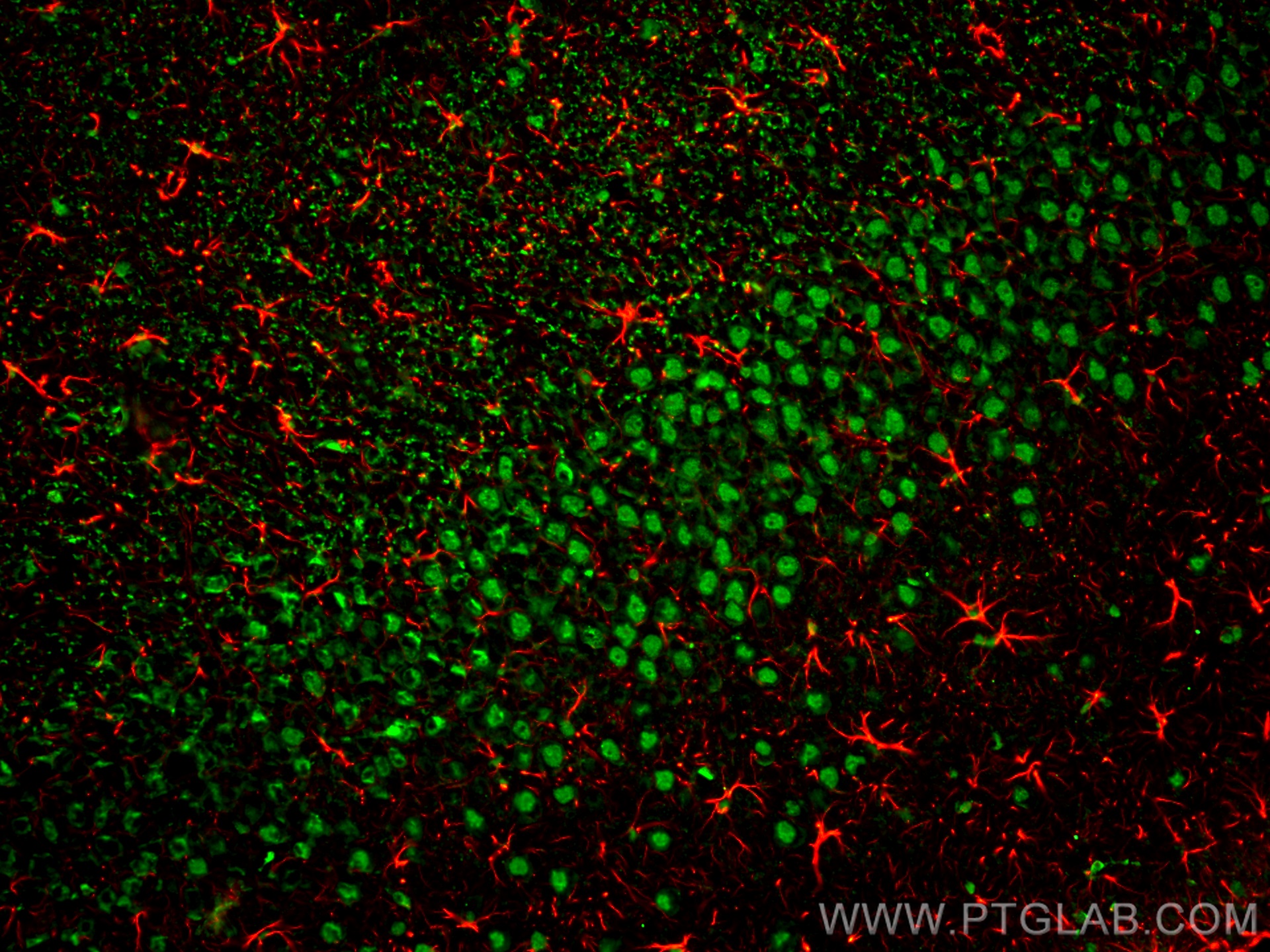 Immunofluorescence of rat brain: rat brain FFPE section was stained with Rabbit anti-GFAP polyclonal antibody (16825-1-AP, 1:200, red) and mouse anti-NeuN monoclonal antibody (66836-1-Ig, green). Multi-rAb™ CoraLite® Plus 594 conjugated Recombinant Goat anti-rabbit secondary antibody (RGAR004, 1:500) and Multi-rAb™ CoraLite® Plus 488 conjugated Goat Anti-Mouse Recombinant Secondary Antibody (H+L) were used for detection (RGAM002, 1:500) . 
