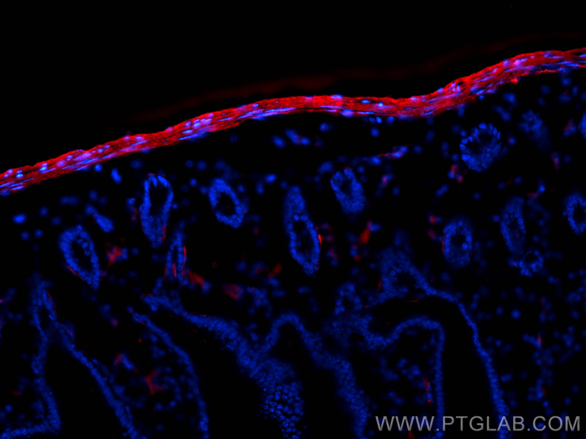 Immunofluorescent analysis of (4% PFA) fixed OCT-embedded frozen mouse small intestine tissue using smooth muscle actin antibody (14395-1-AP) at dilution of 1:400 and Multi-rAb™ CoraLite ® Plus 594-Goat Anti-Rabbit Recombinant Secondary Antibody (H+L) (RGAR004).