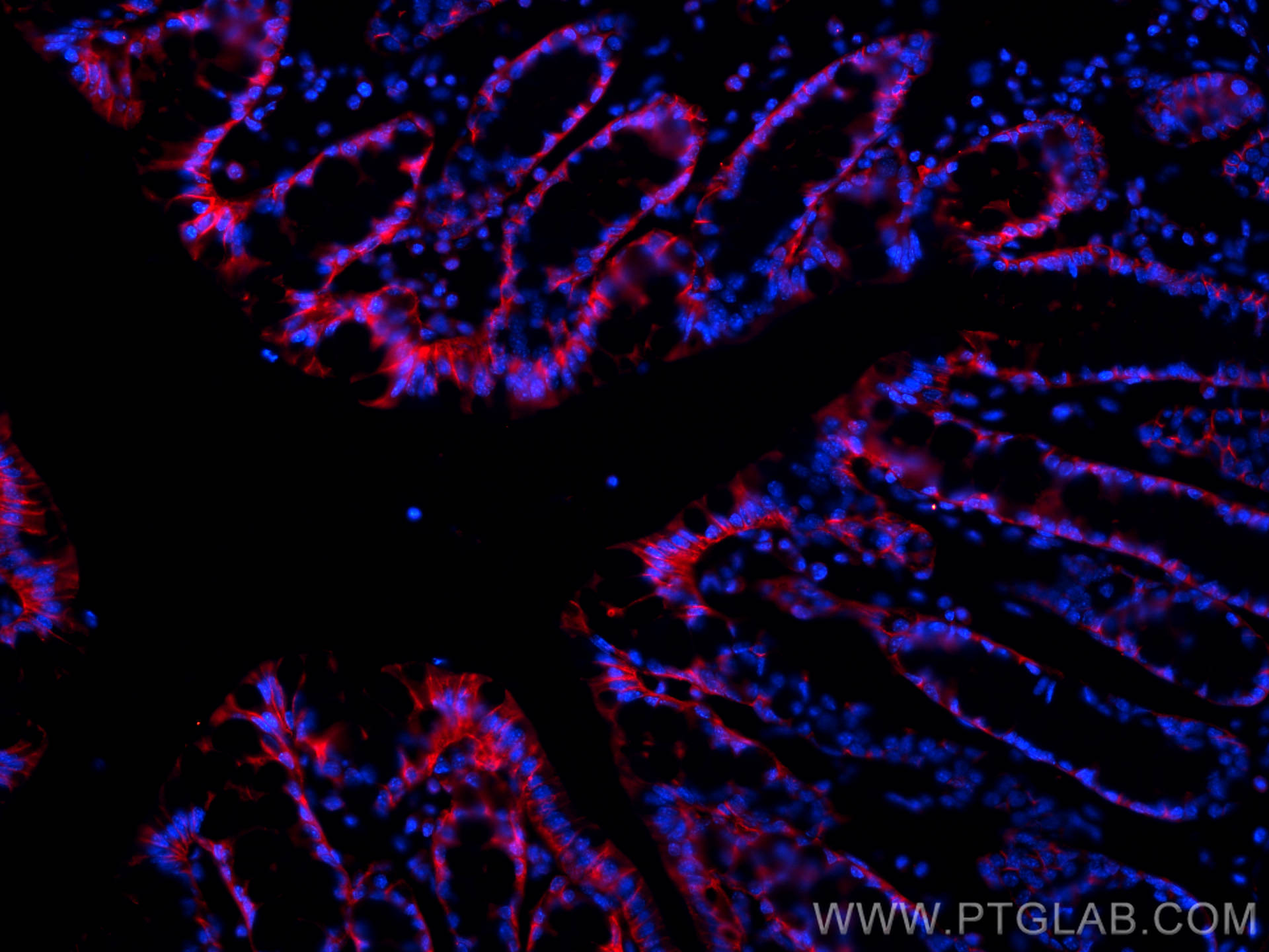 Immunofluorescent analysis of (4% PFA) fixed OCT-embedded frozen mouse colon tissue using E-cadherin antibody (20874-1-AP) at dilution of 1:400 and Multi-rAb™ CoraLite ® Plus 594-Goat Anti-Rabbit Recombinant Secondary Antibody (H+L) (RGAR004).