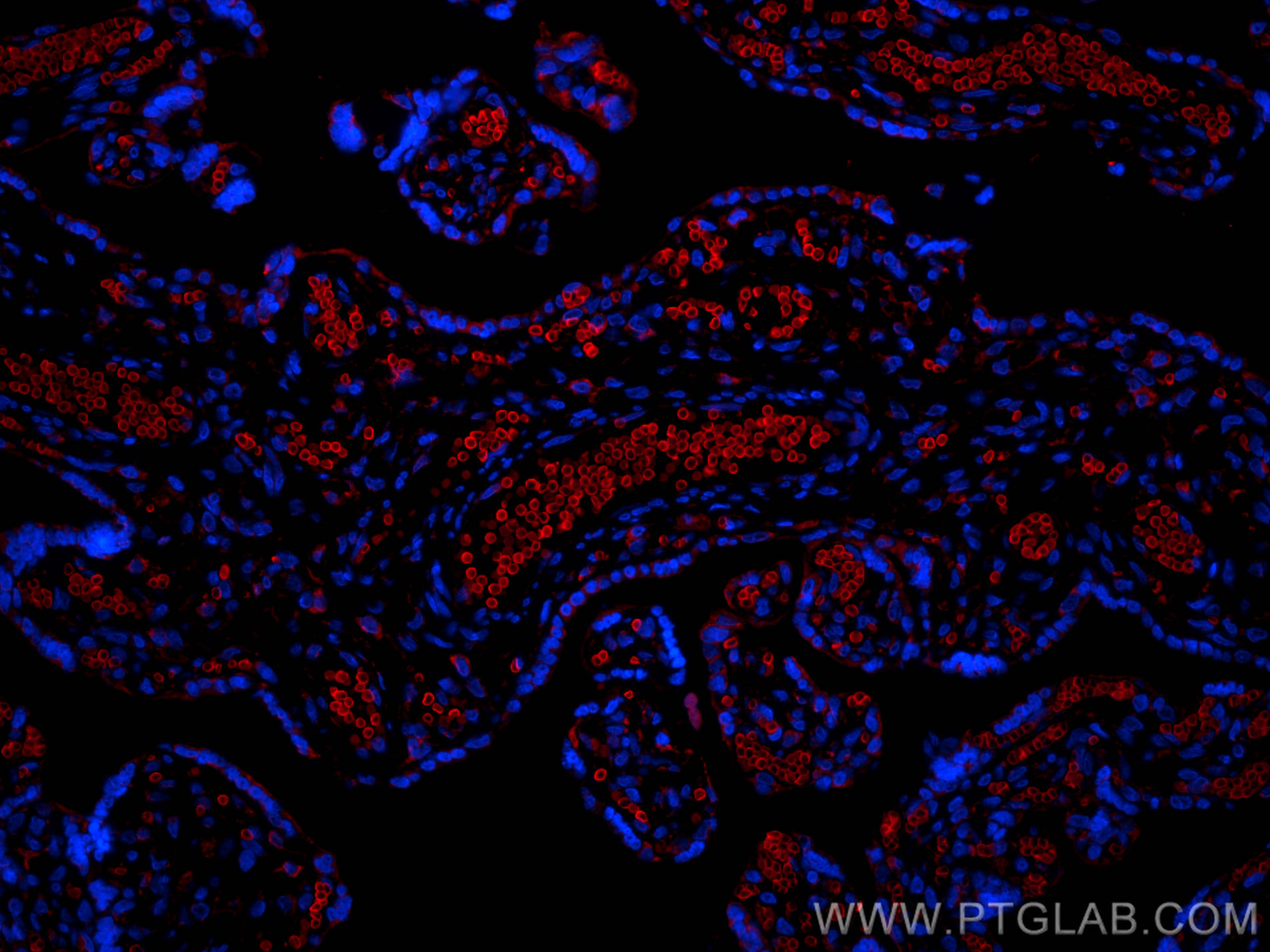 Immunofluorescent analysis of (4% PFA) fixed paraffin-embedded human placenta tissue using Band 3 / AE1 antibody (81066-1-RR, Clone: 3K21 ) at dilution of 1:200 and Multi-rAb™ CoraLite ® Plus 594-Goat Anti-Rabbit Recombinant Secondary Antibody (H+L) (RGAR004). Heat mediated antigen retrieval with Tris-EDTA buffer (pH 9.0).