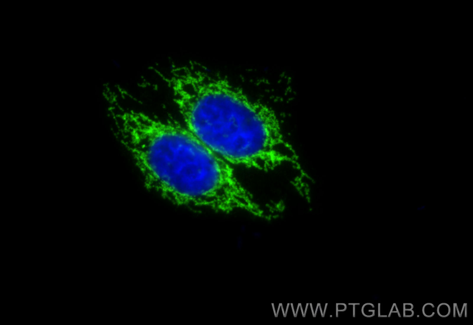 Immunofluorescent analysis of (4% PFA) fixed HepG2 cells using TOM20 antibody (11802-1-AP) at dilution of 1:200 and CoraLite488-conjugated Donkey Anti-Rabbit IgG(H+L). Immunofluorescent analysis of (4% PFA) fixed HepG2 cells using TOM20 antibody (11802-1-AP) at dilution of 1:200 and CoraLite488-conjugated Donkey Anti-Rabbit IgG(H+L).