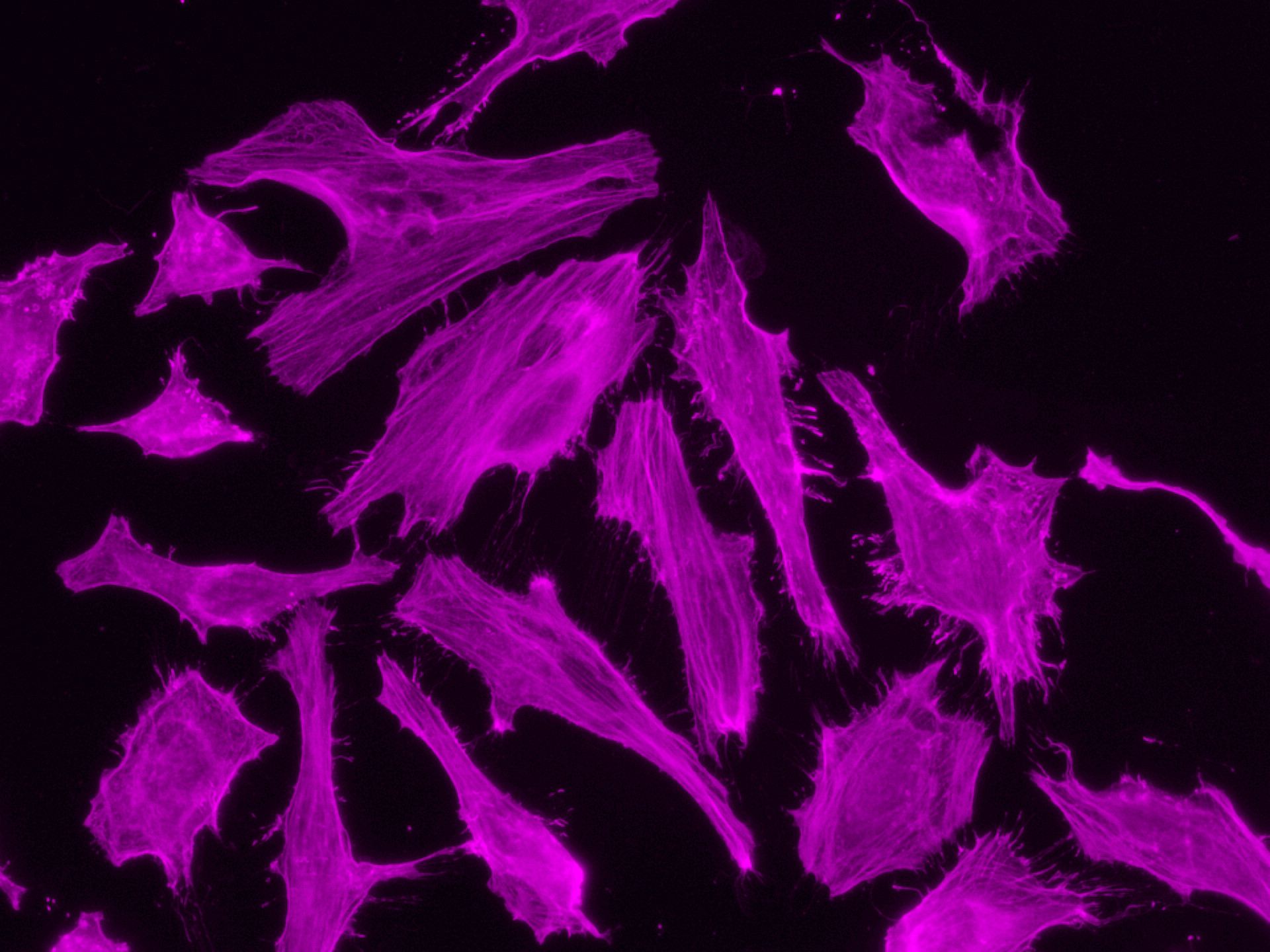 Immunofluorescent analysis of (4% PFA) fixed HeLa cells using 66009-1-Ig (Beta Actin antiboody) and CoraLite®647 conjugated F(ab')2 Fragment Donkey Anti-Mouse IgG (H+L) antibody (SA00014-8) at dilution of 1:150.