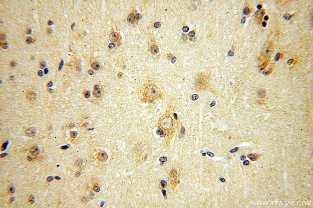 IHC staining of human brain using 16041-1-AP