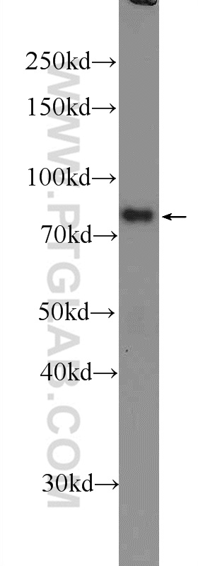 WB analysis of mouse brain using 16041-1-AP