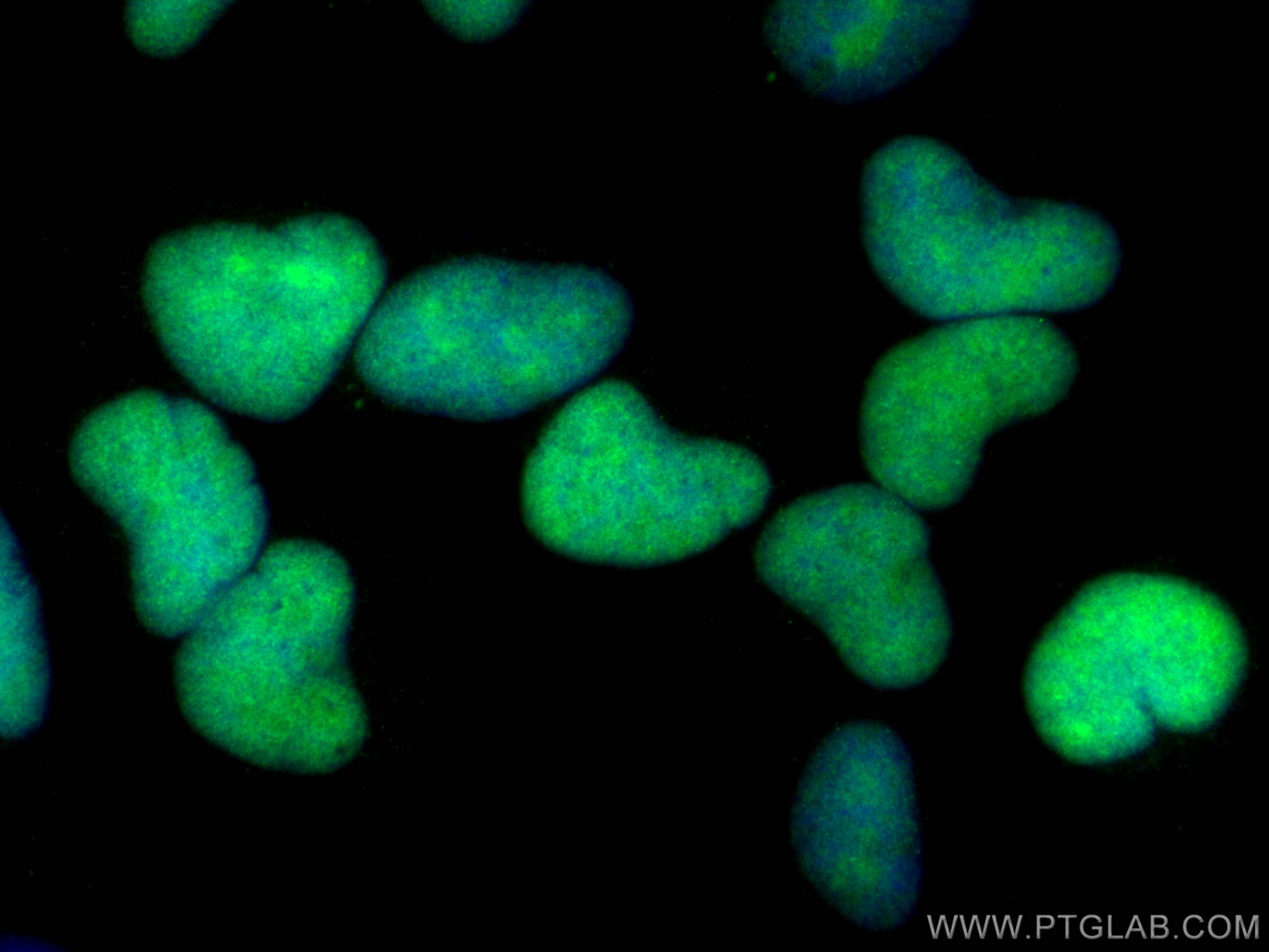 IF Staining of HeLa using 29280-1-AP (same clone as 29280-1-PBS) IF Staining of HeLa using 29280-1-AP (same clone as 29280-1-PBS)