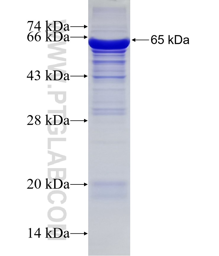 IFI16 fusion protein Ag3102 SDS-PAGE