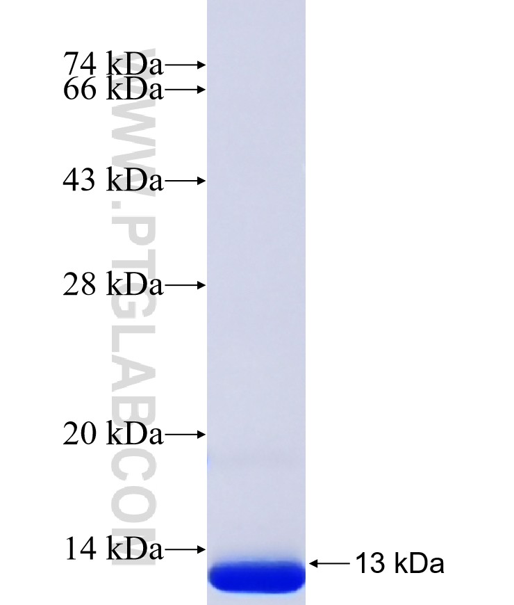 IFI27 fusion protein Ag40468 SDS-PAGE IFI27 fusion protein Ag40468 SDS-PAGE