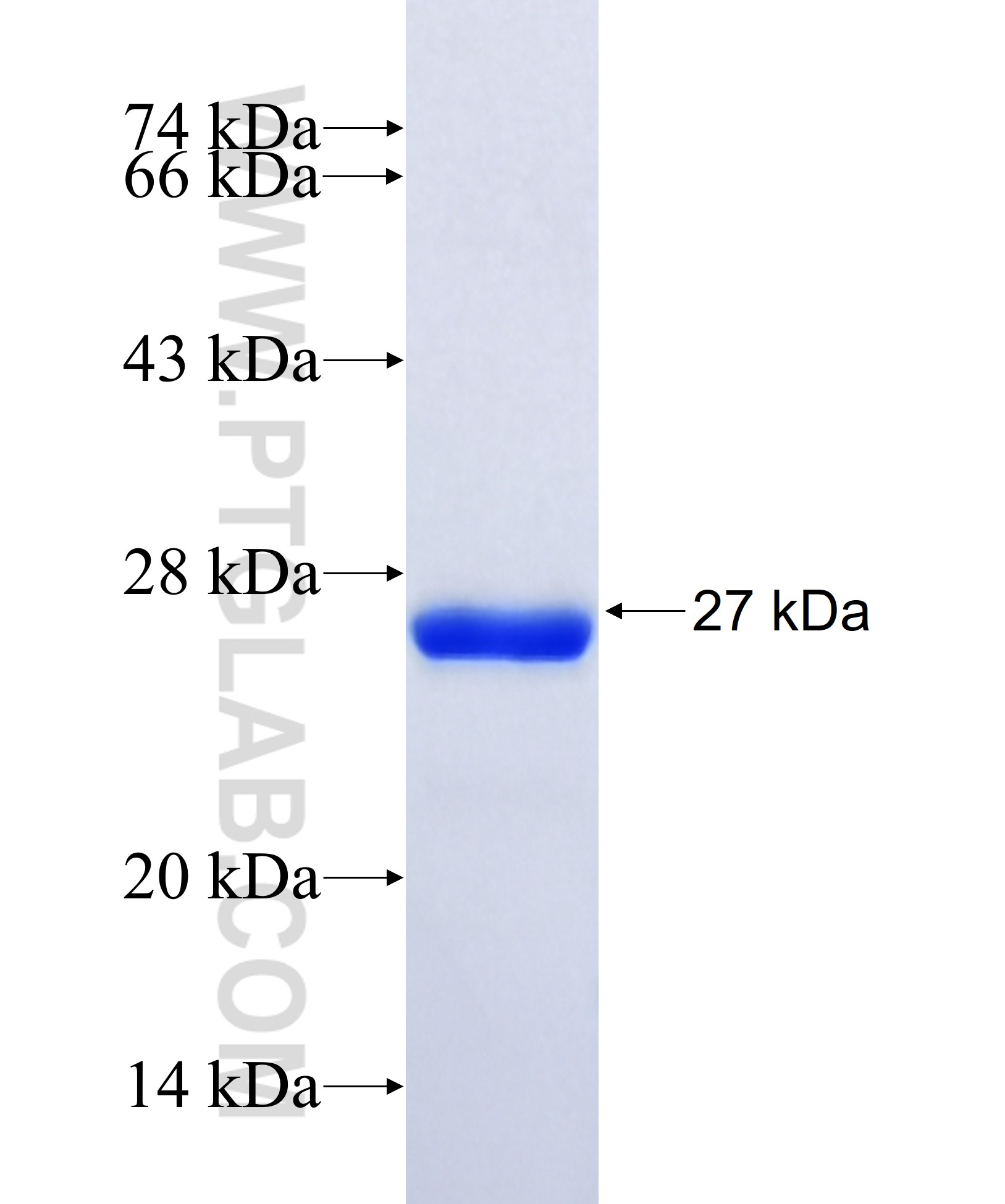 IFI35 fusion protein Ag34694 SDS-PAGE IFI35 fusion protein Ag34694 SDS-PAGE
