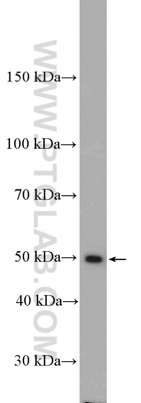 WB analysis of mouse kidney using 27233-1-AP