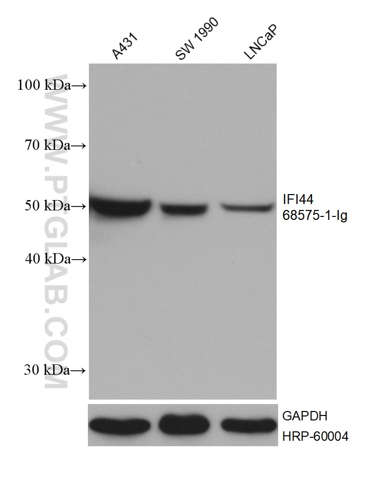 WB analysis using 68575-1-Ig (same clone as 68575-1-PBS)